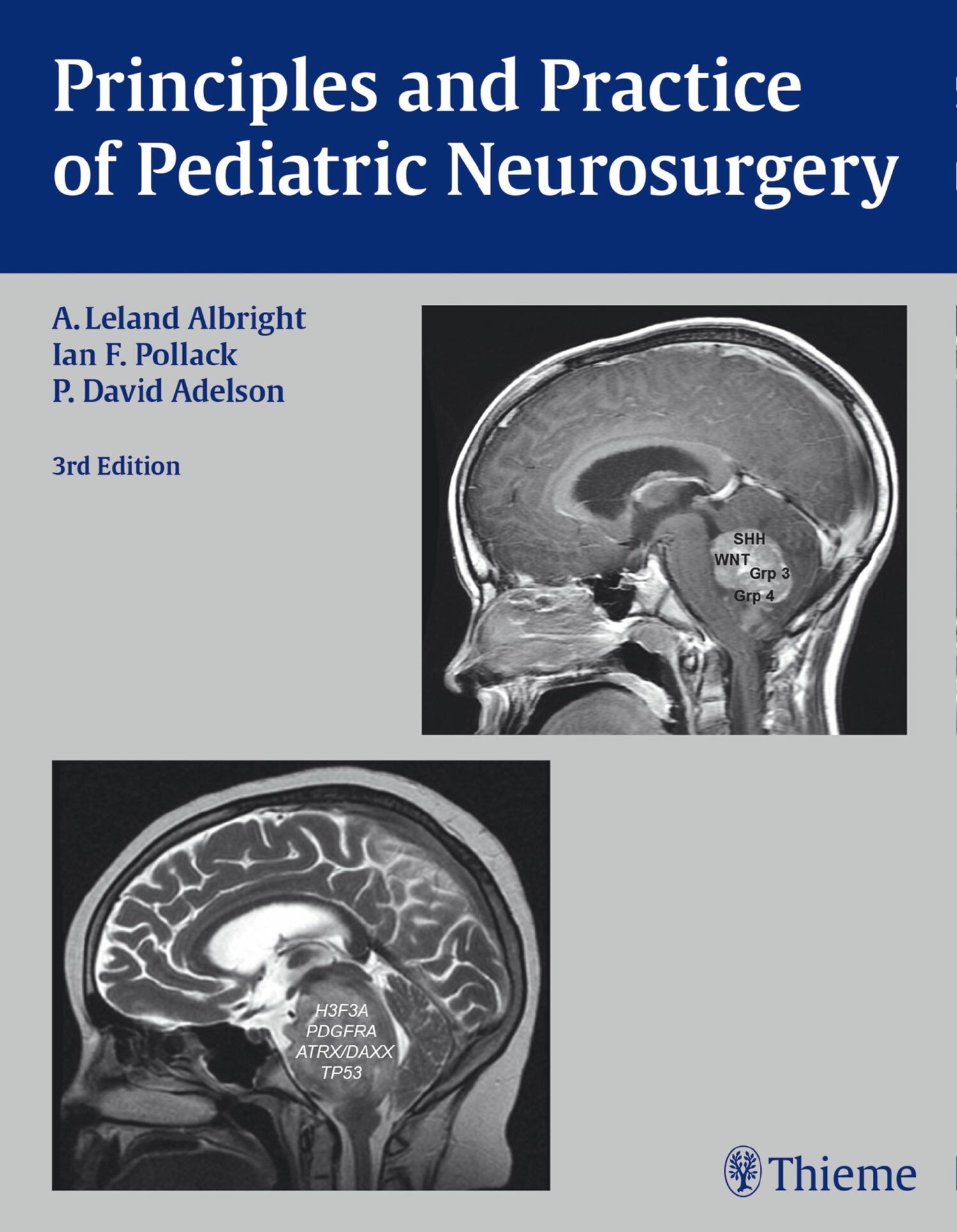 Cover Principles and Practice of Pediatric Neurosurgery