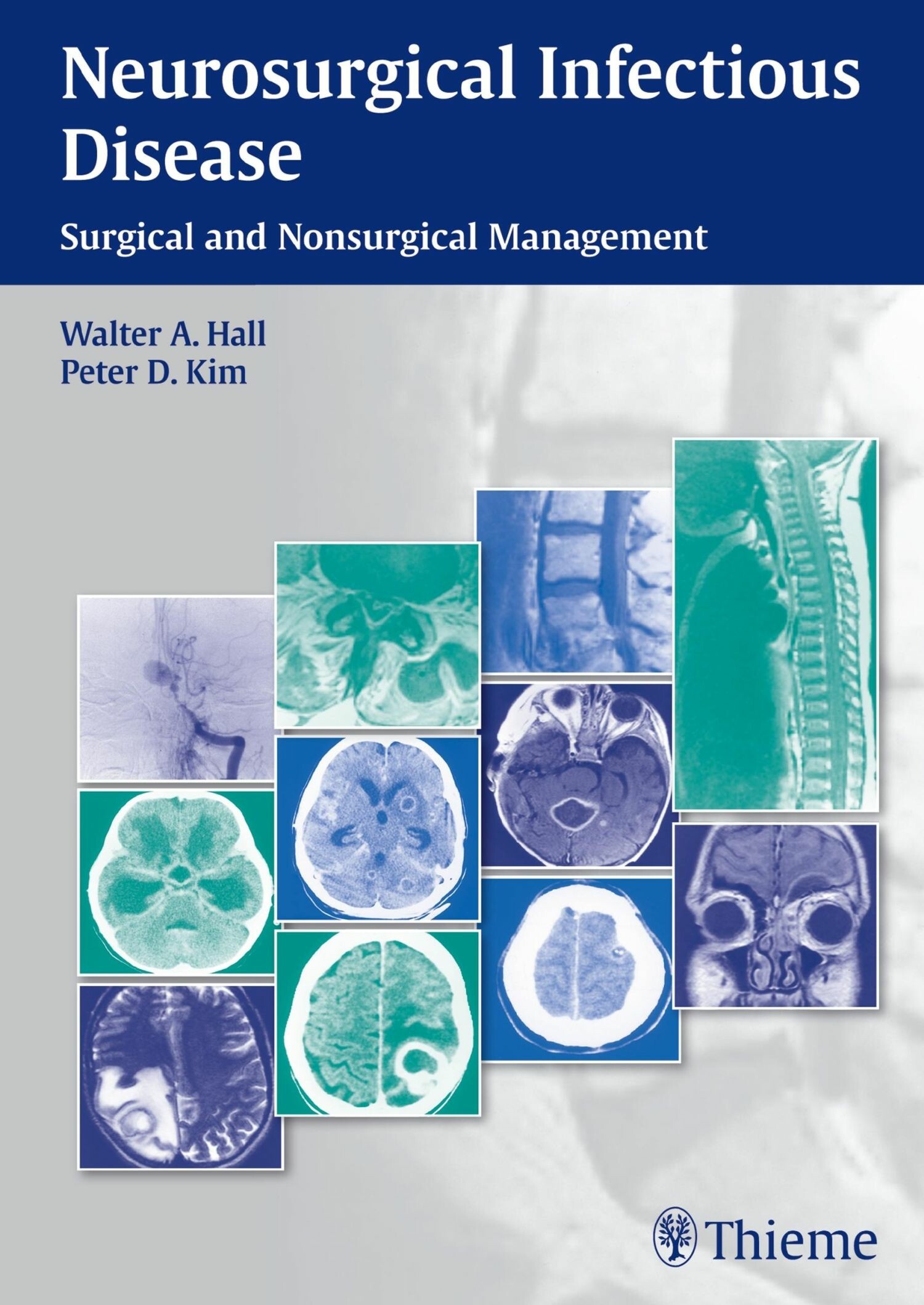Cover Neurosurgical Infectious Disease