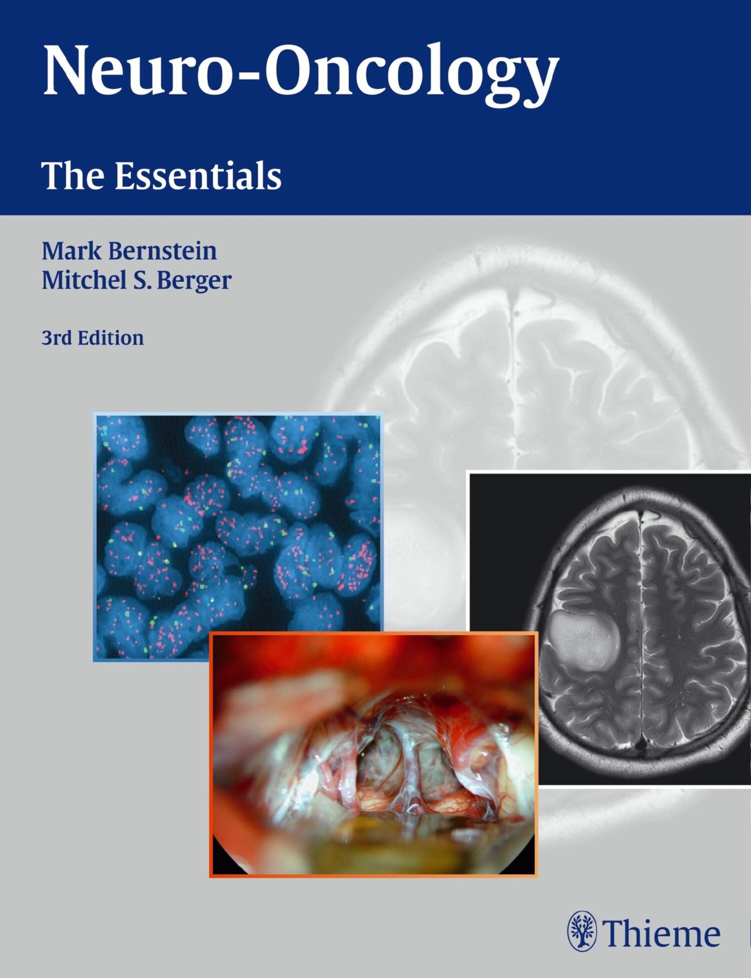 Cover Neuro-Oncology: The Essentials
