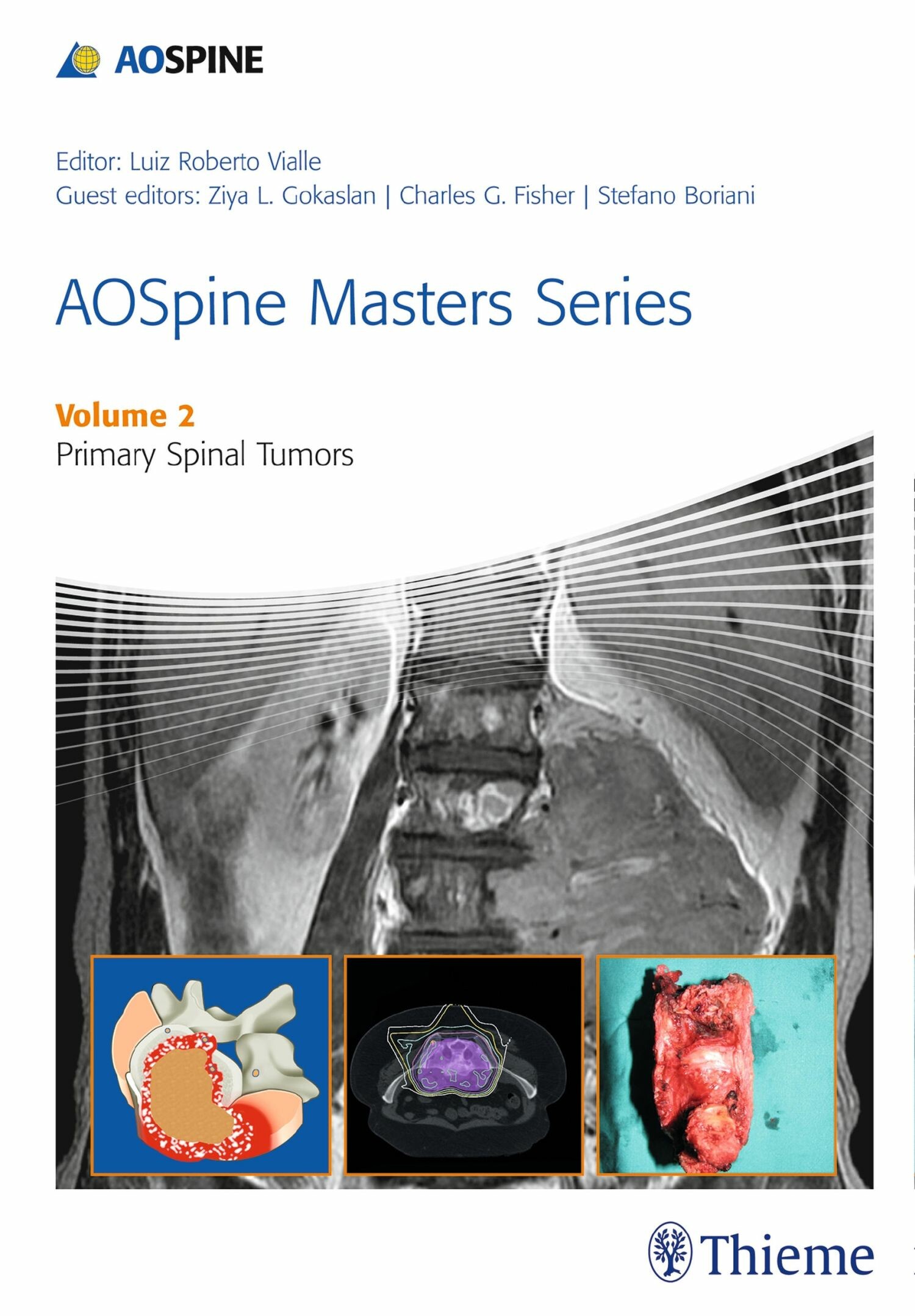 Cover AOSpine Masters Series, Volume 2: Primary Spinal Tumors