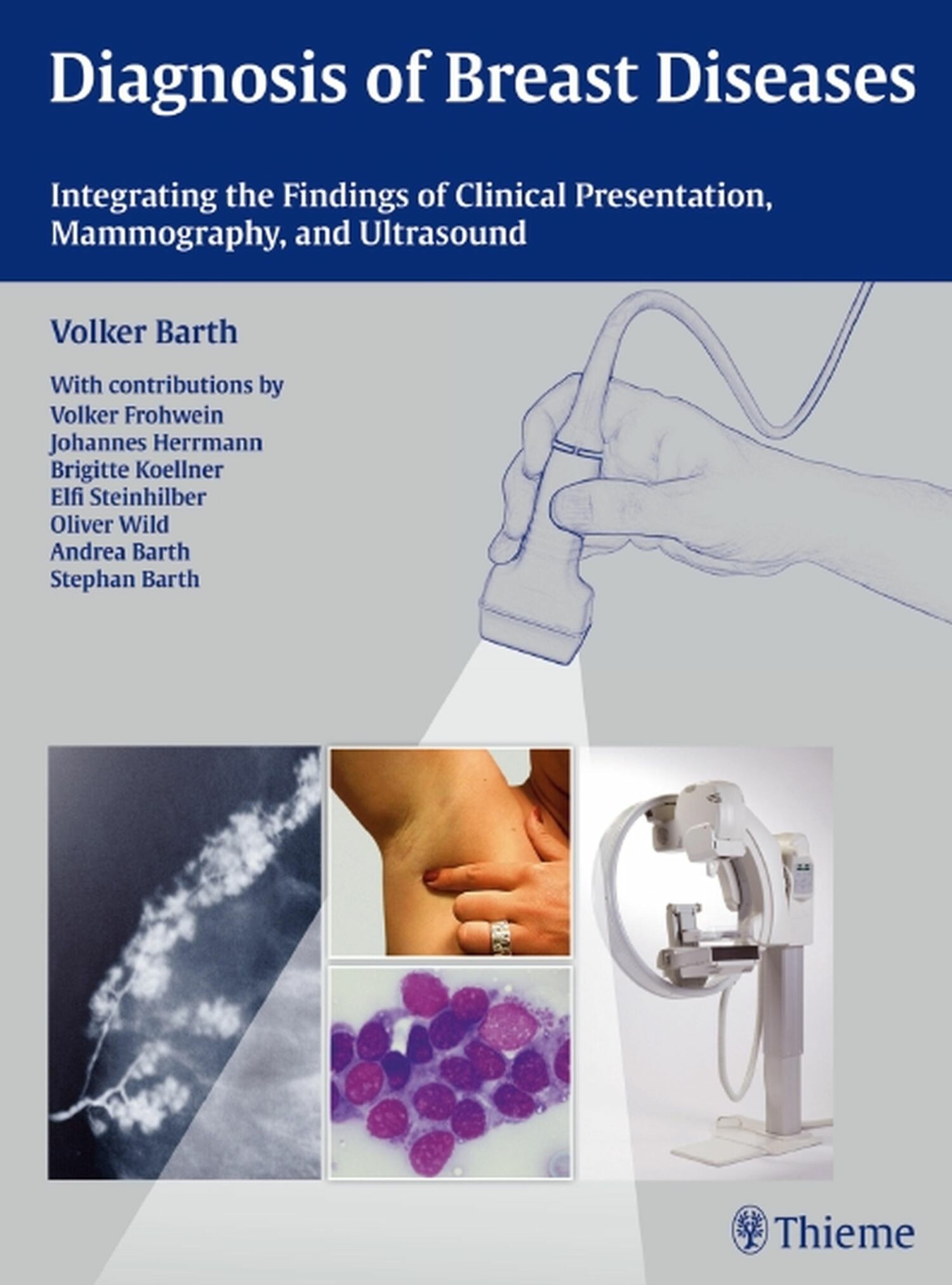 Cover Diagnosis of Breast Diseases