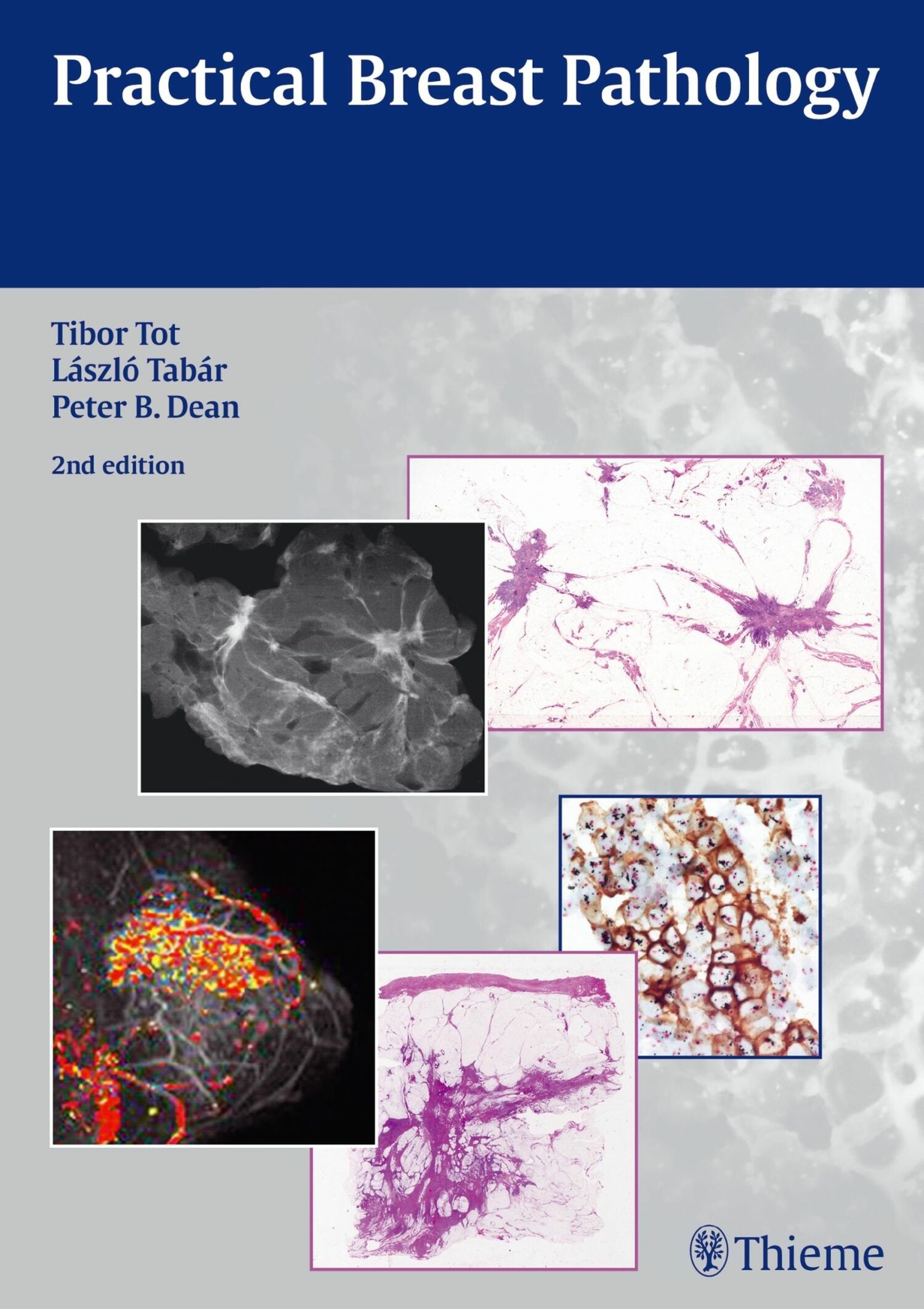 Cover Practical Breast Pathology