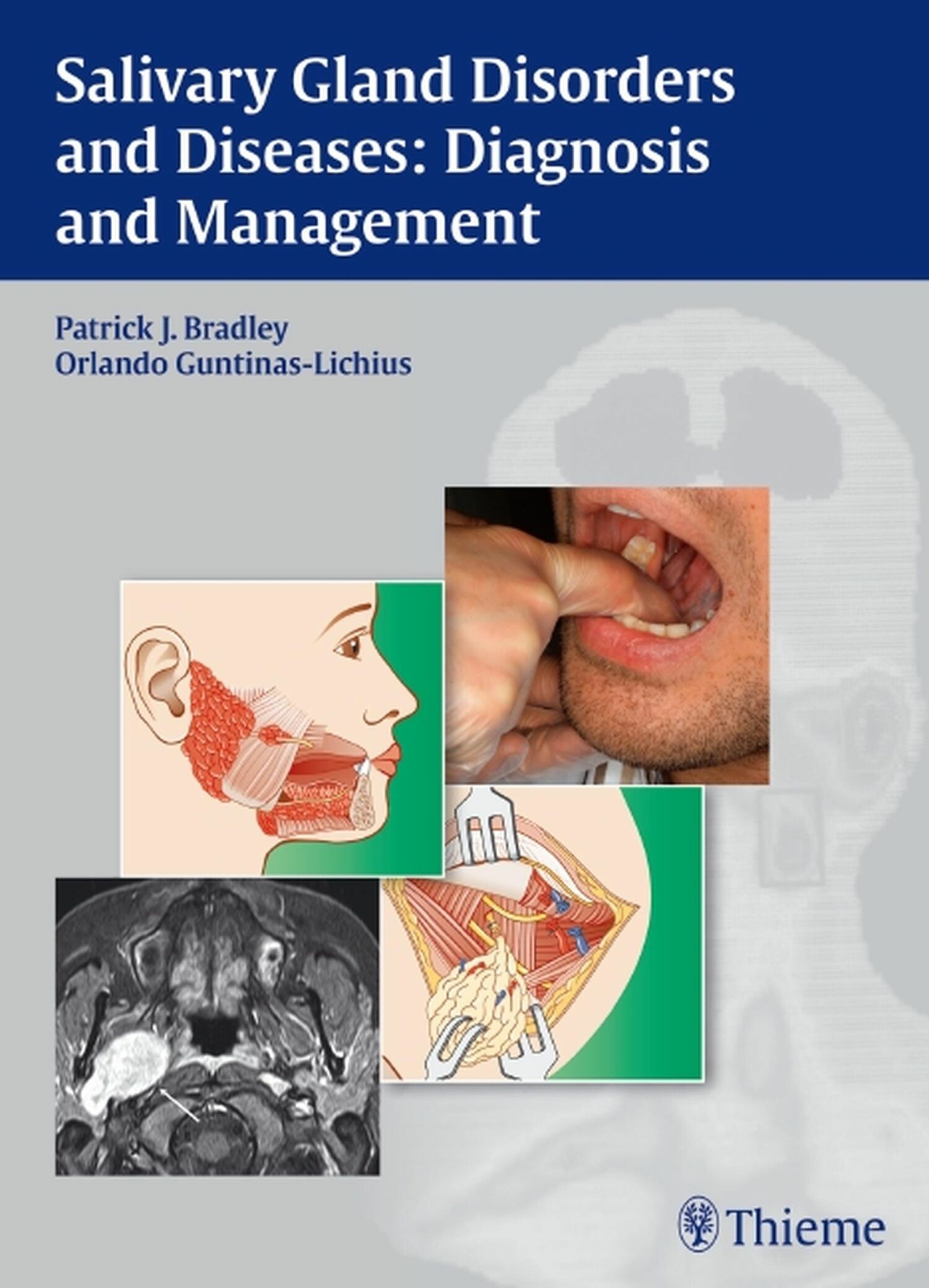 Cover Salivary Gland Disorders and Diseases