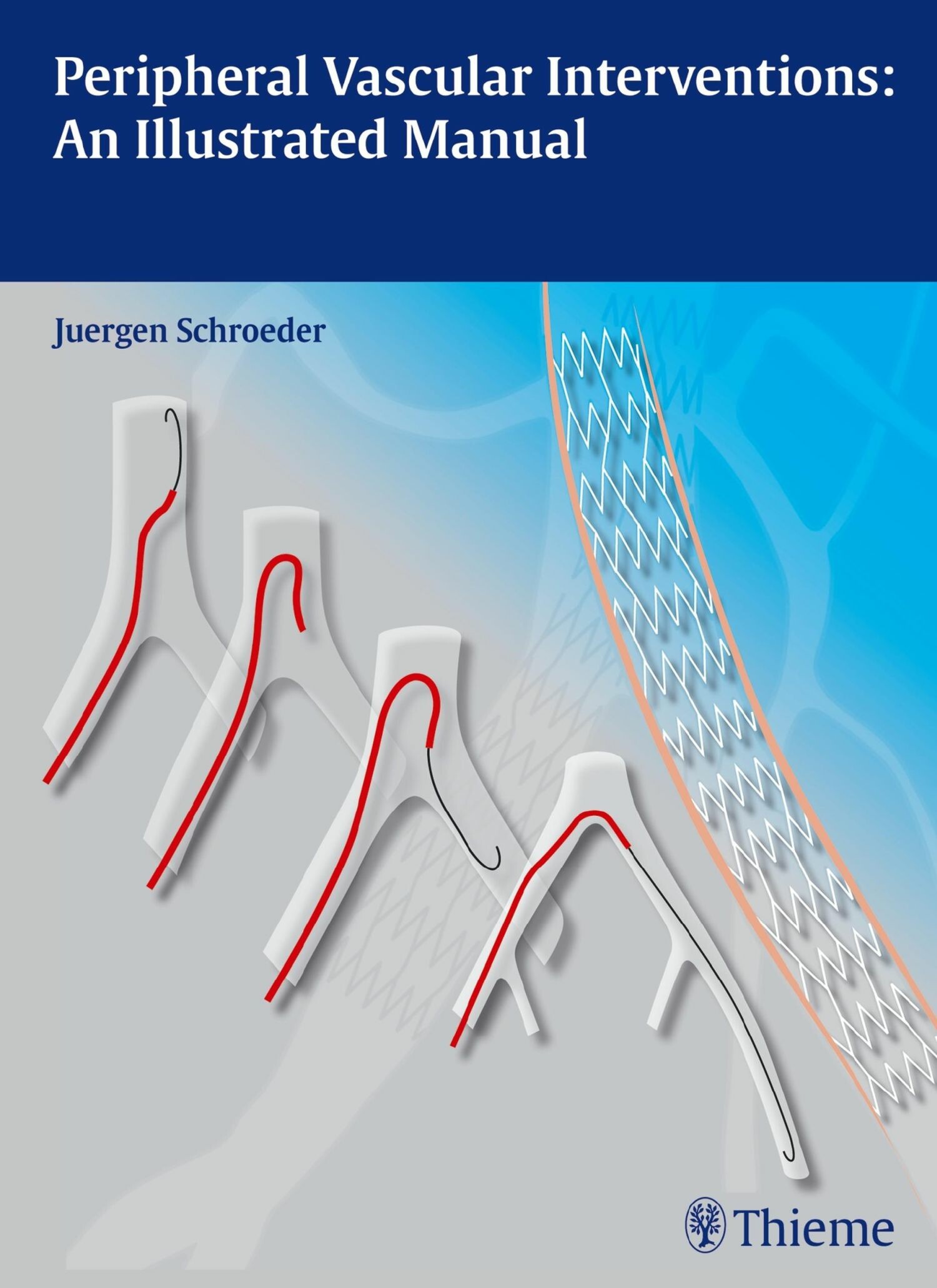 Cover Peripheral Vascular Interventions: An Illustrated Manual