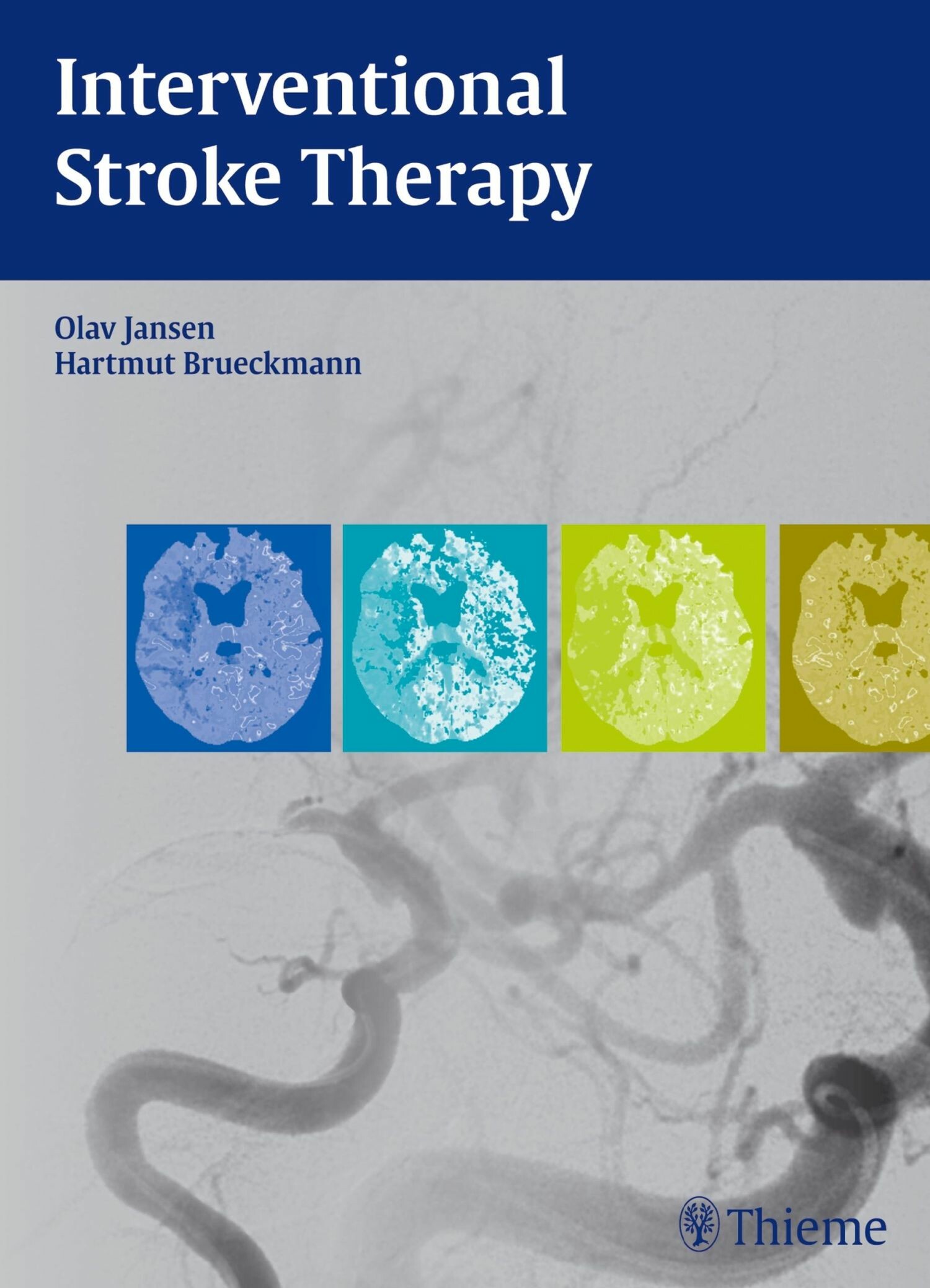 Cover Interventional Stroke Therapy