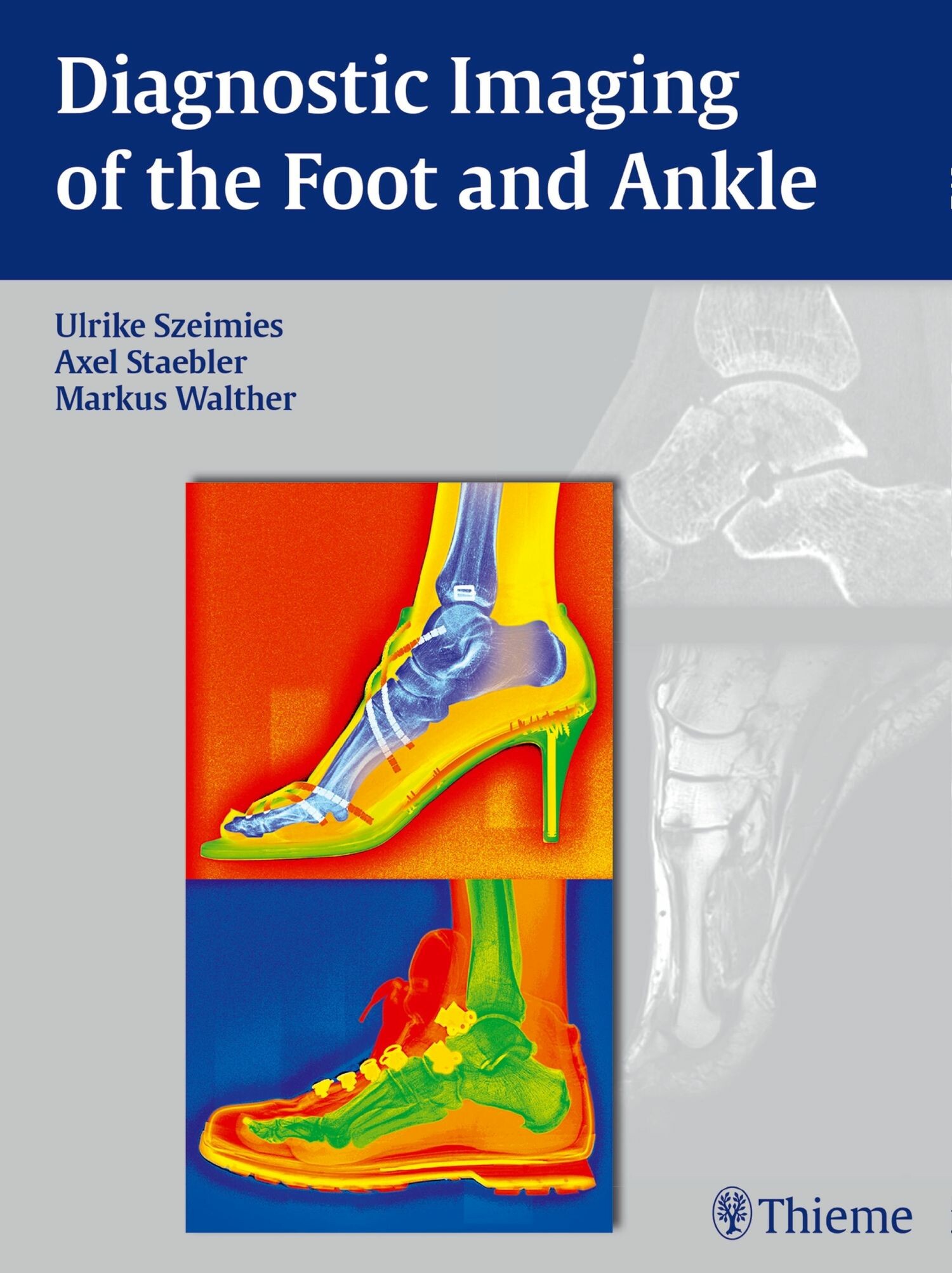 Cover Diagnostic Imaging of the Foot and Ankle