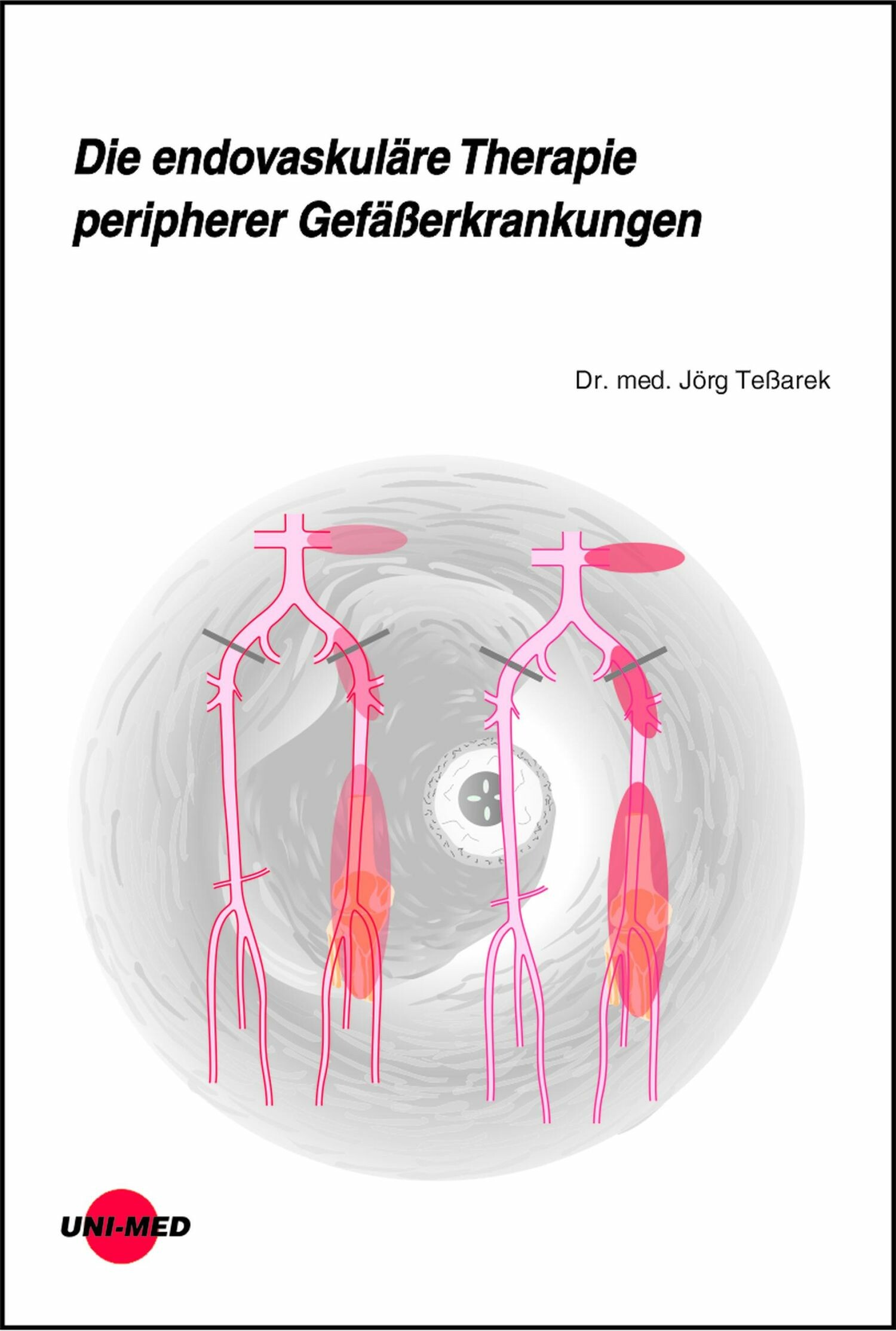 Cover Die endovaskuläre Therapie peripherer Gefäßerkrankungen