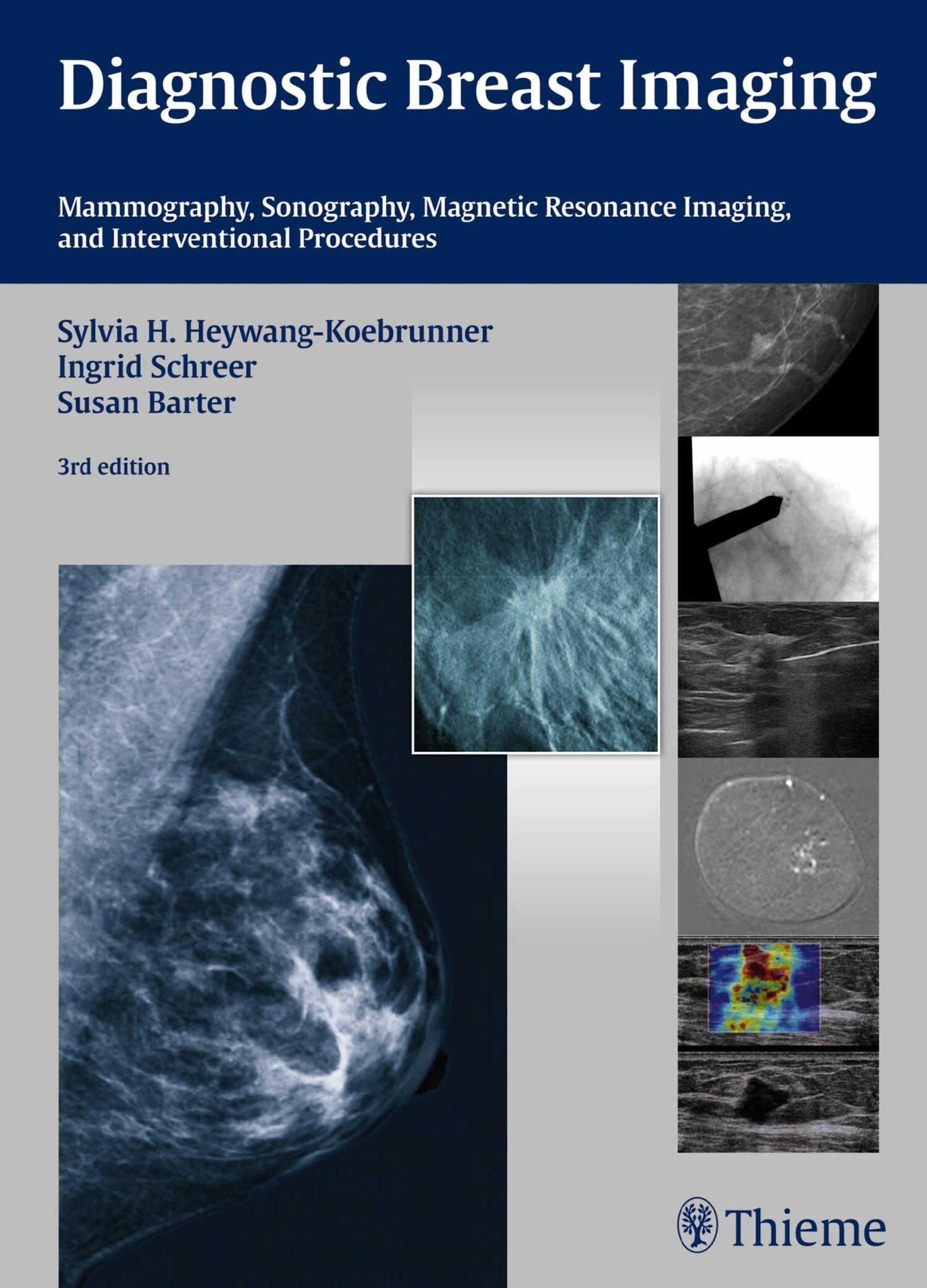 Cover Diagnostic Breast Imaging