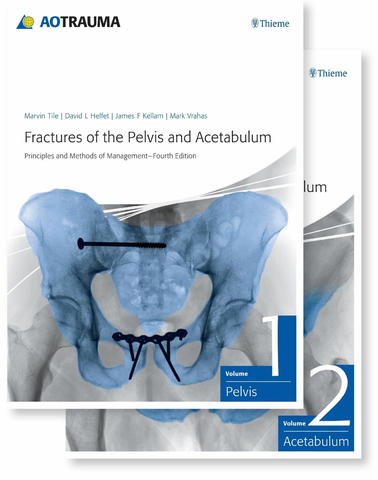 Fractures of the Pelvis and Acetabulum