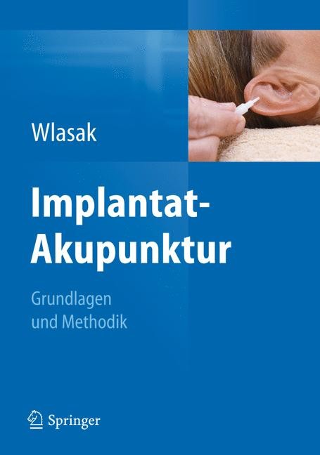 Cover Implantat-Akupunktur