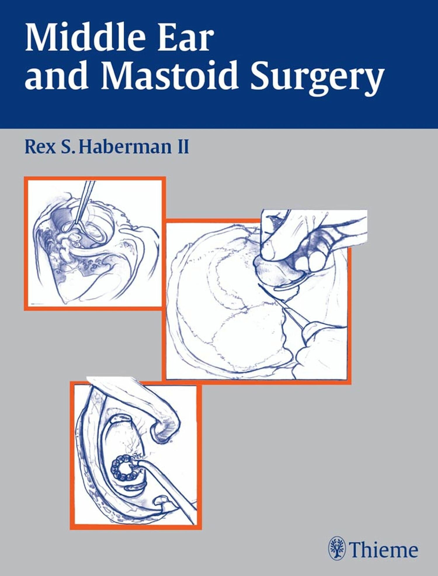 Cover Middle Ear and Mastoid Surgery