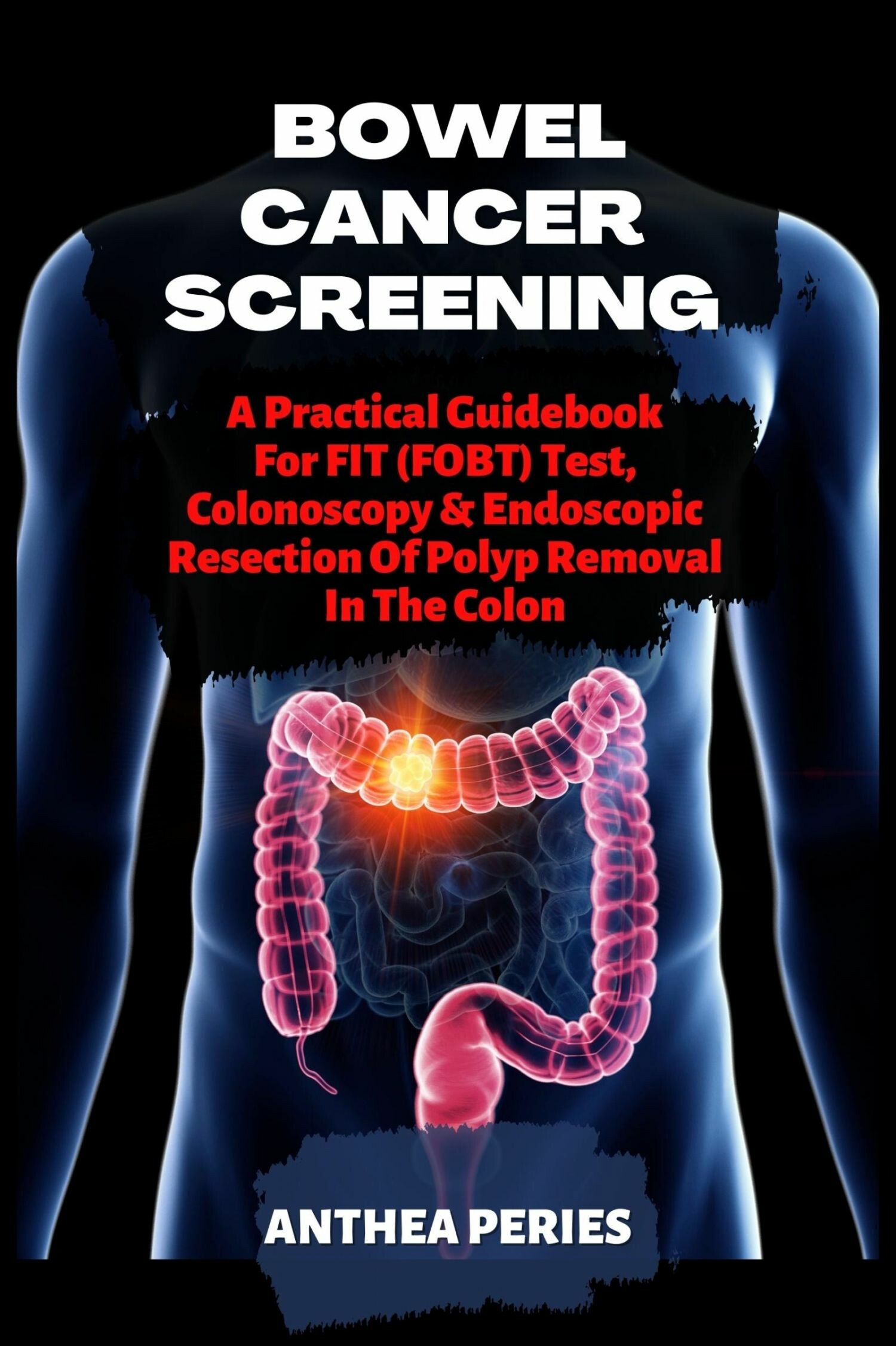 Bowel Cancer Screening