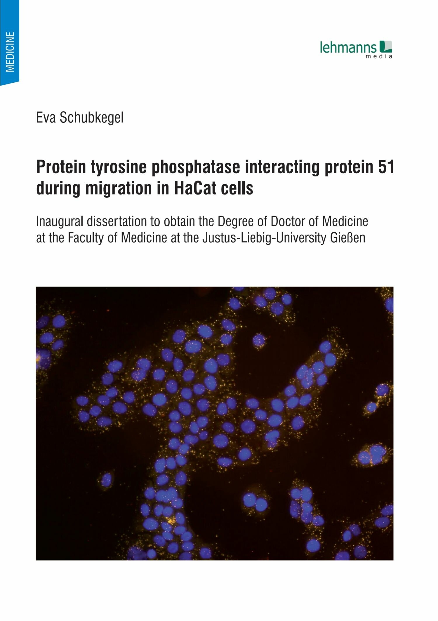 Cover Protein tyrosine phosphatase interacting protein 51 during migration in HaCat cells