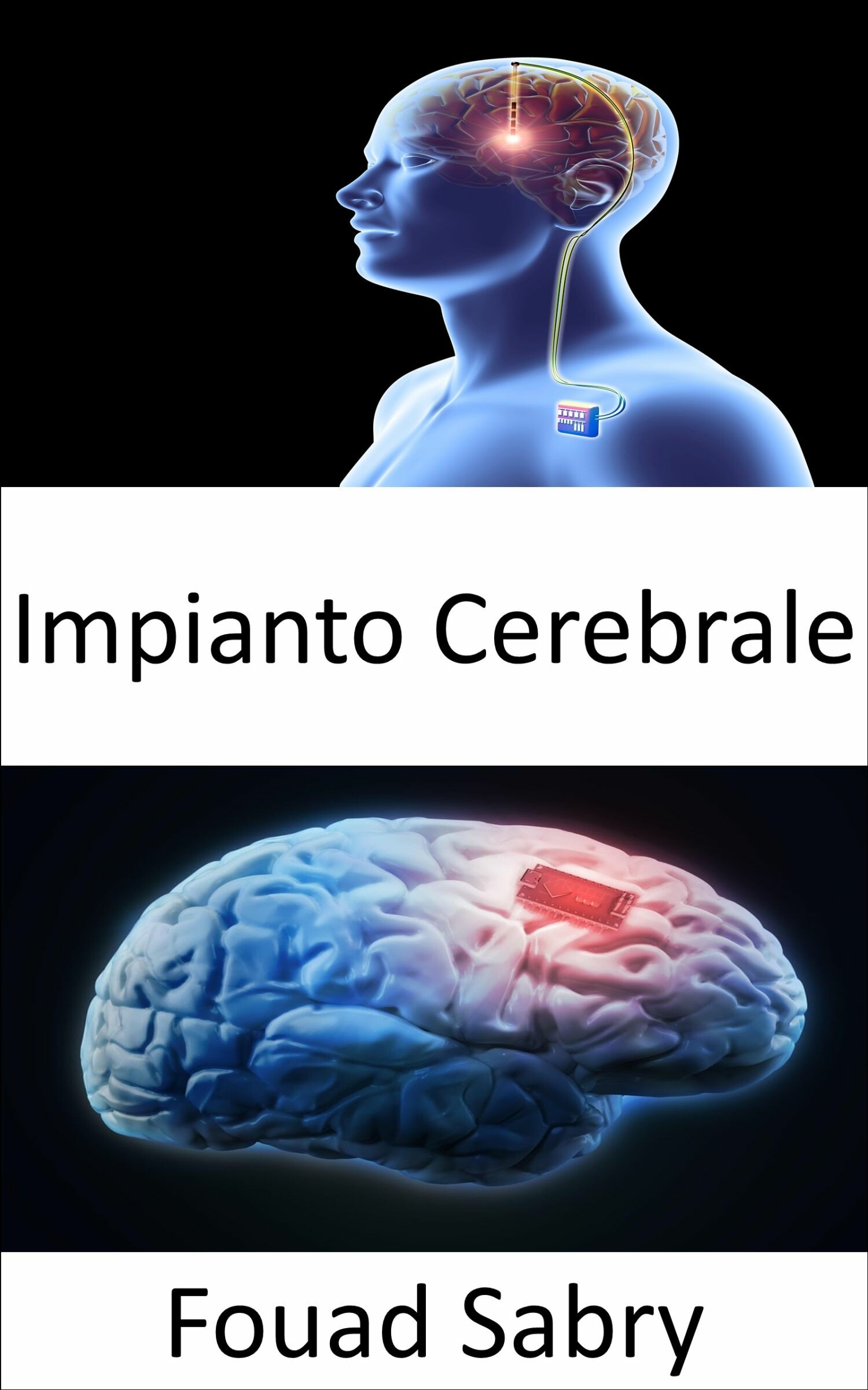 Impianto Cerebrale