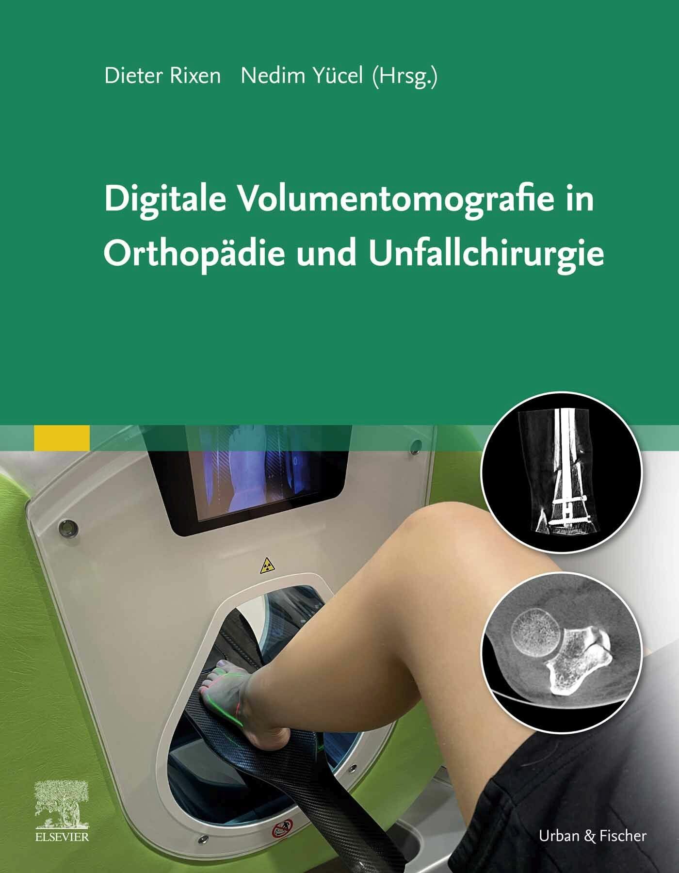 Cover Digitale Volumentomografie in Orthopädie und Unfallchirurgie