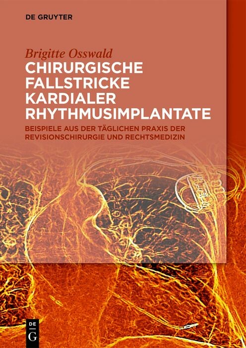 Cover Chirurgische Fallstricke kardialer Rhythmusimplantate