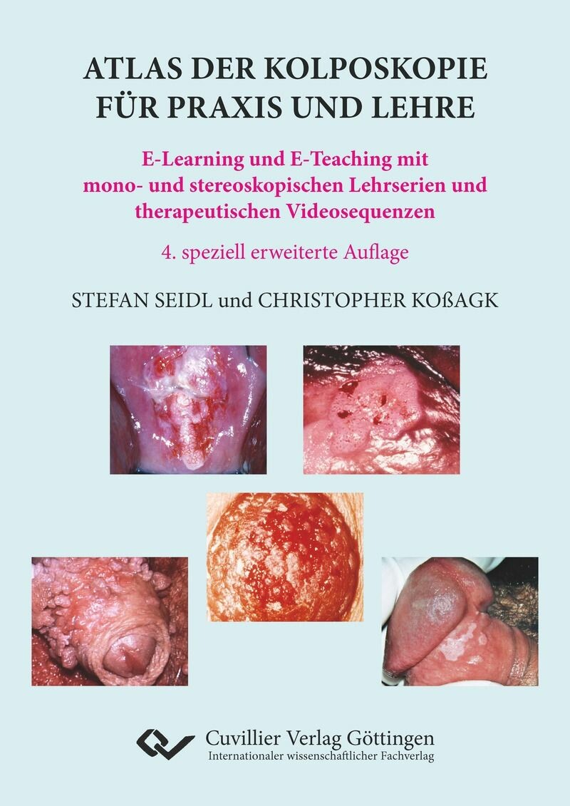 Cover Atlas der Kolposkopie f&#xFC;r Praxis und Lehre