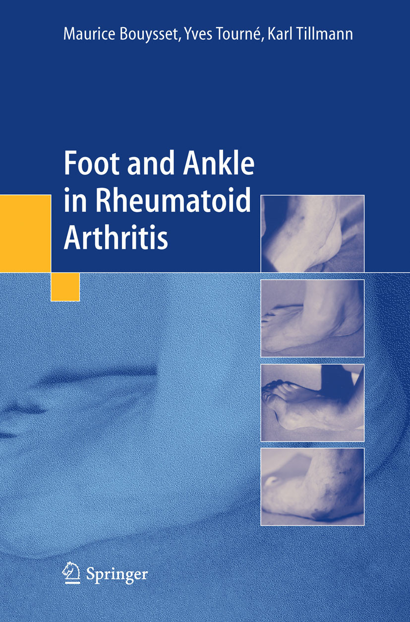 Cover Foot and ankle in rheumatoid arthritis
