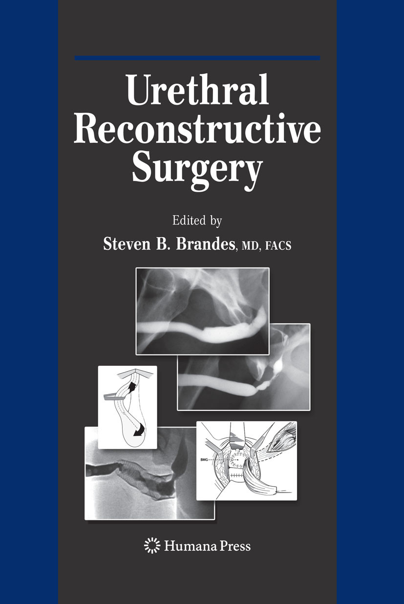 Cover Urethral Reconstructive Surgery