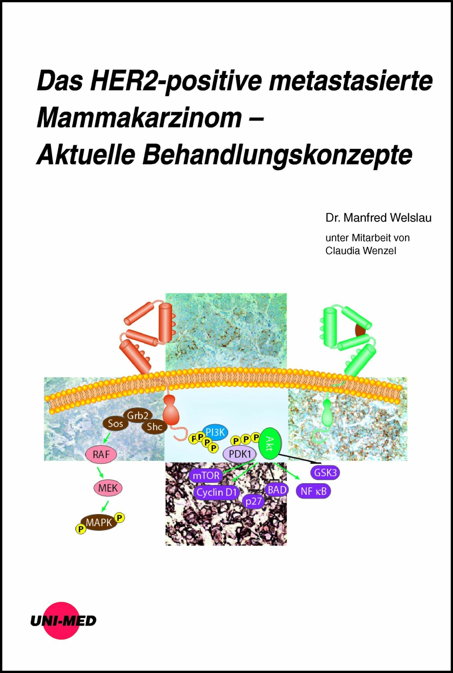 Cover Das HER2-positive metastasierte Mammakarzinom - Aktuelle Behandlungskonzepte
