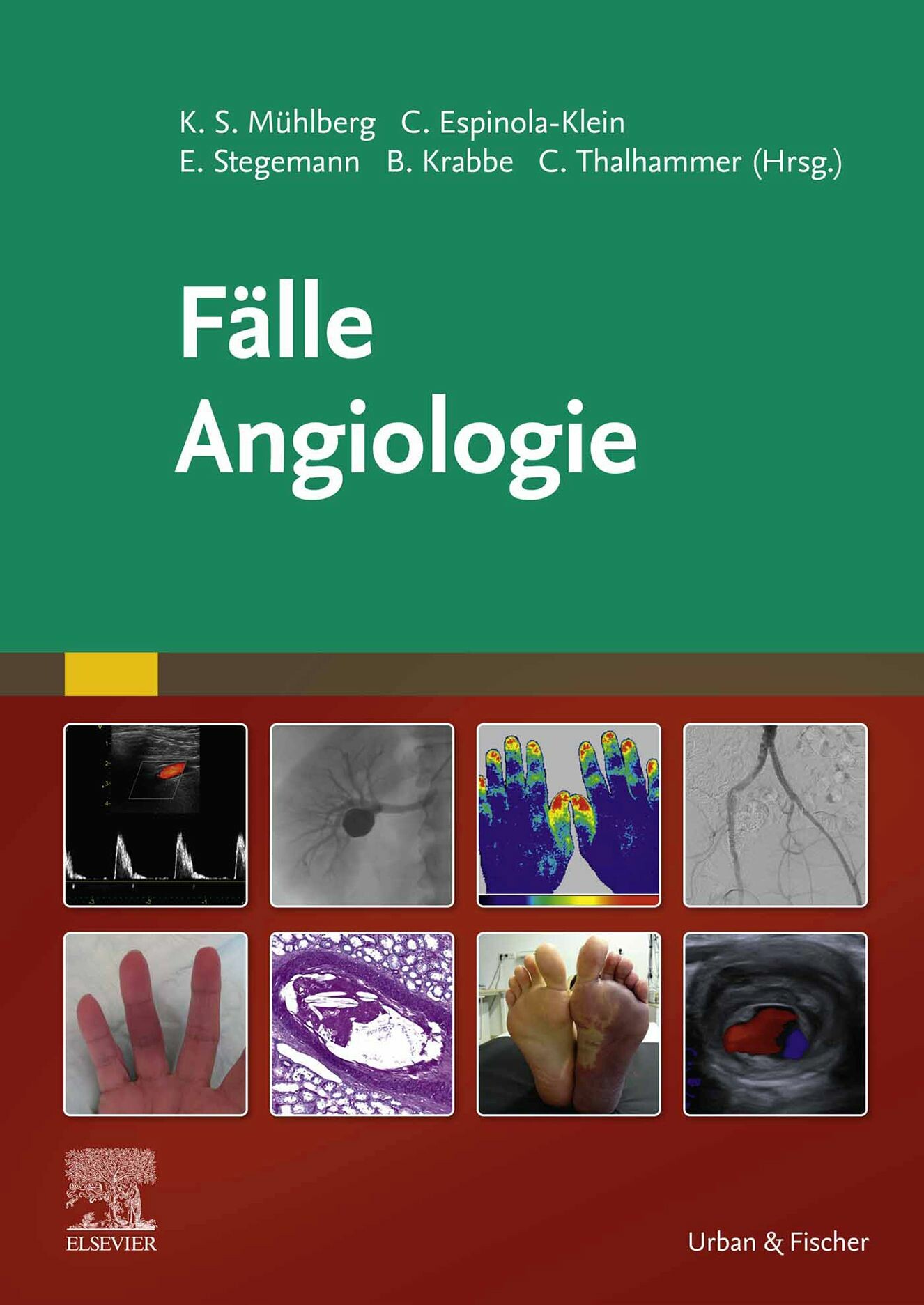 Fälle Angiologie