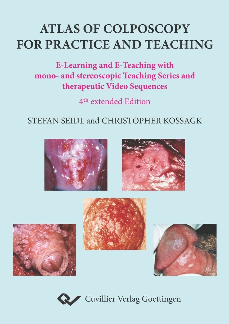 Cover Atlas of Colposcopy for Practice and Teaching