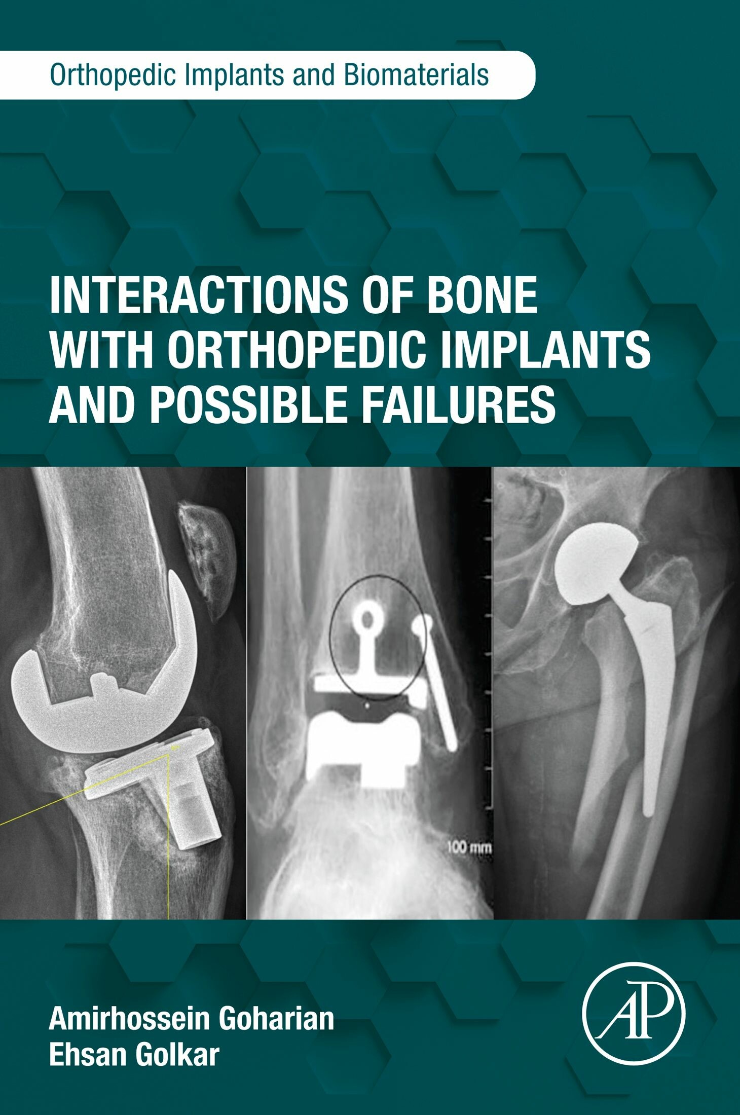 Cover Interactions of Bone with Orthopedic Implants and Possible Failures