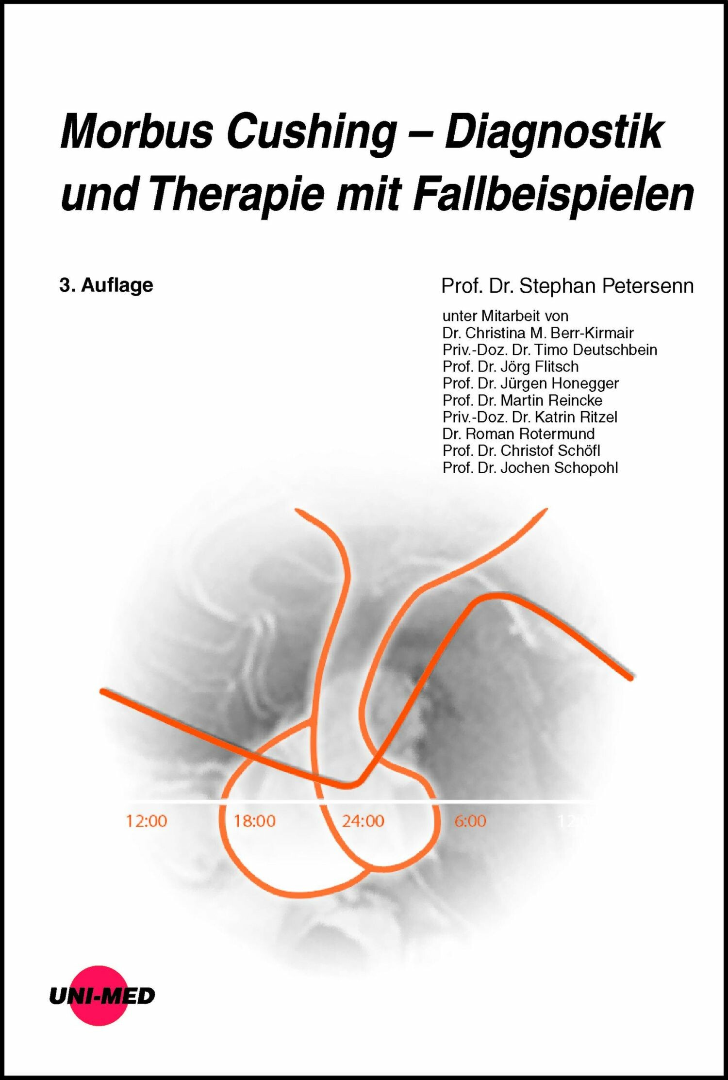 Cover Morbus Cushing - Diagnostik und Therapie mit Fallbeispielen