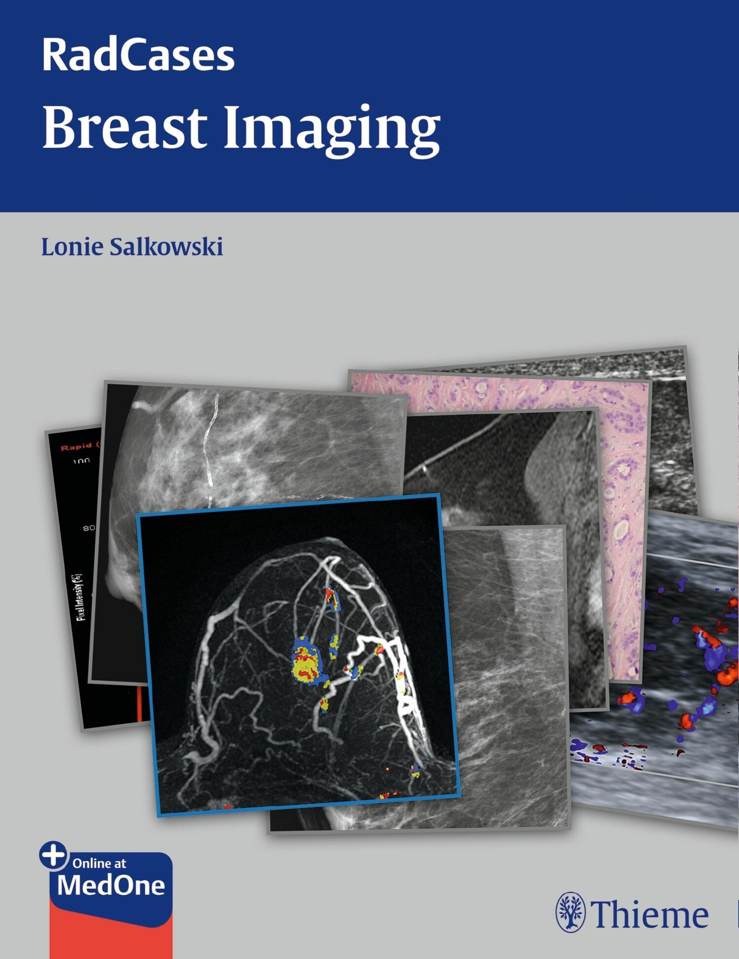 Cover Radcases Breast Imaging