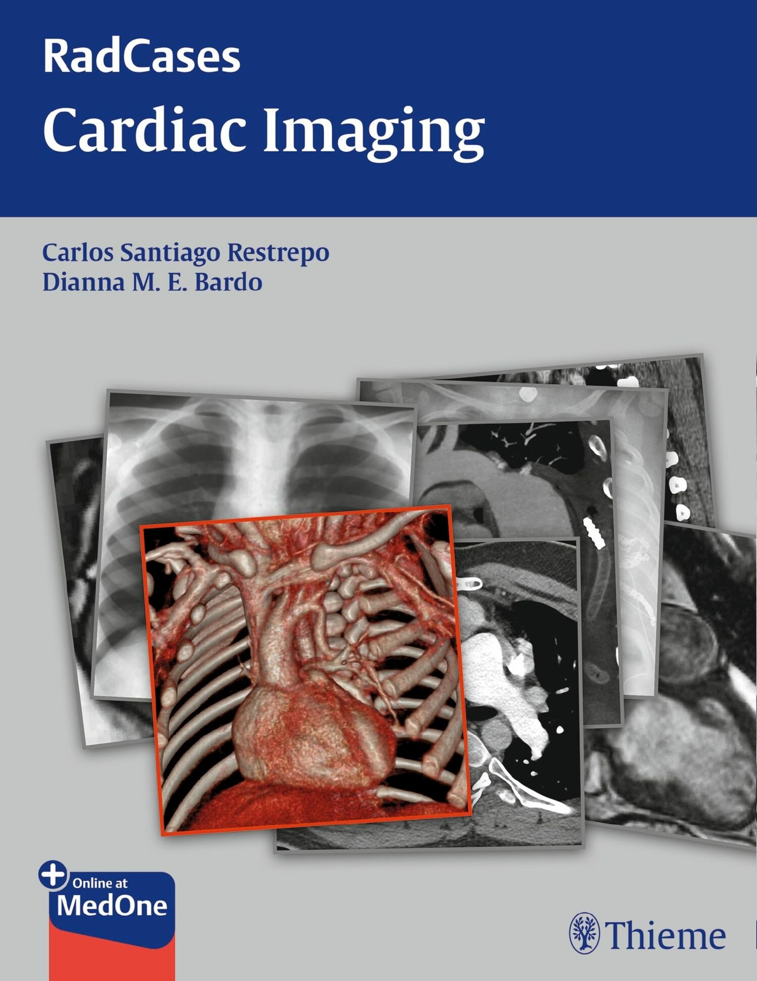 Cover Radcases Cardiac Imaging