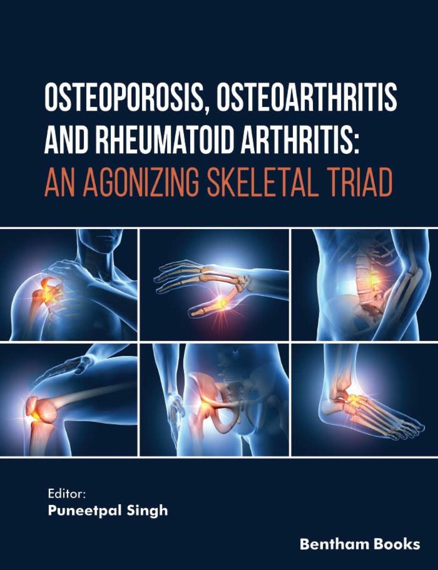 Cover Osteoporosis, Osteoarthritis and Rheumatoid Arthritis: An Agonizing Skeletal Triad