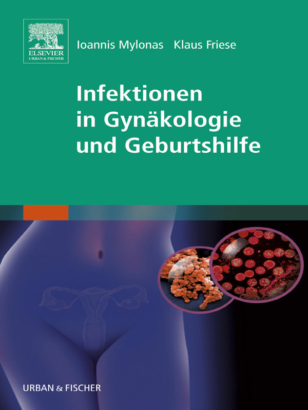 Infektionen in Gynäkologie und Geburtshilfe
