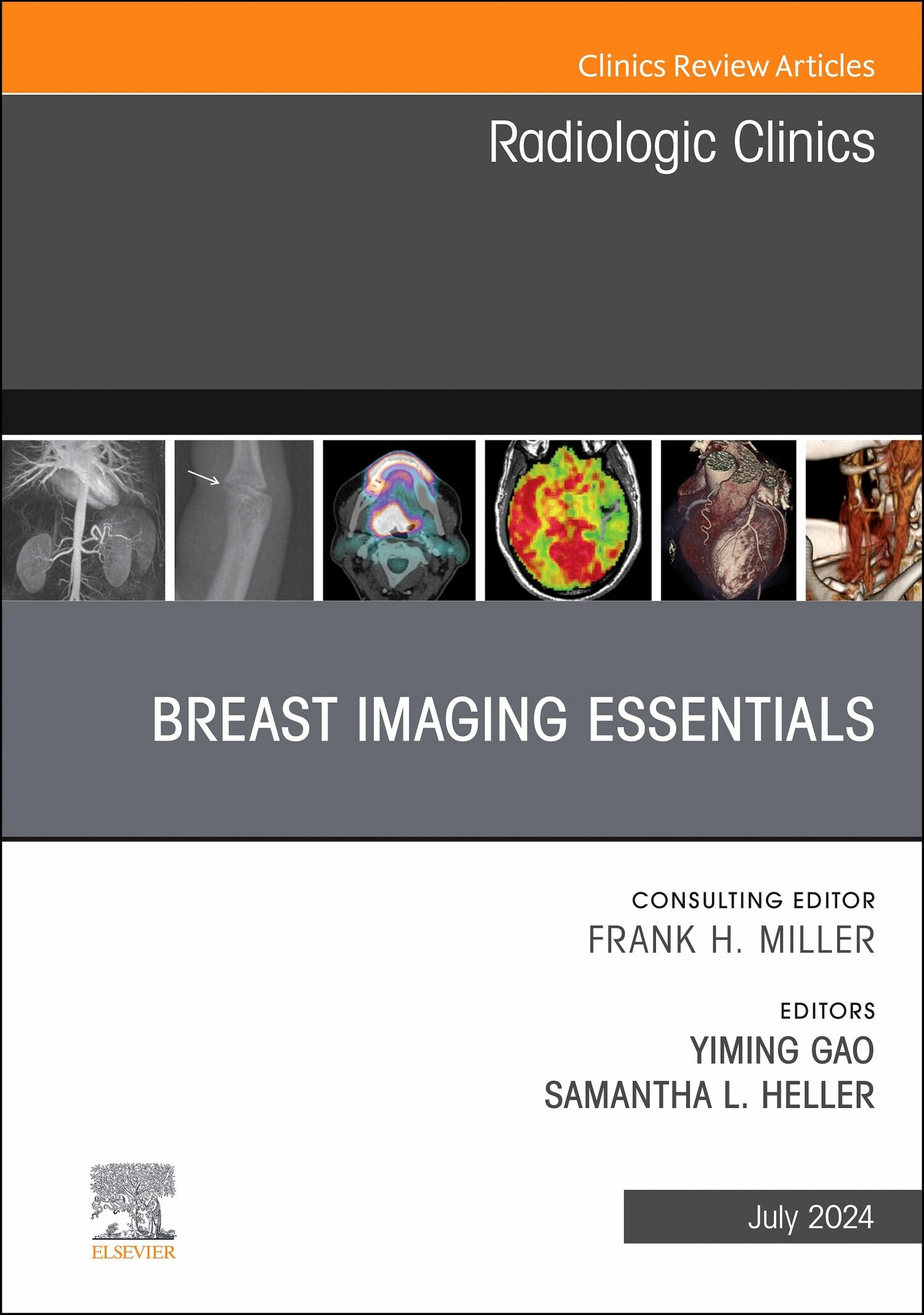 Cover Breast Imaging Essentials, An Issue of Radiologic Clinics of North America, E-Book