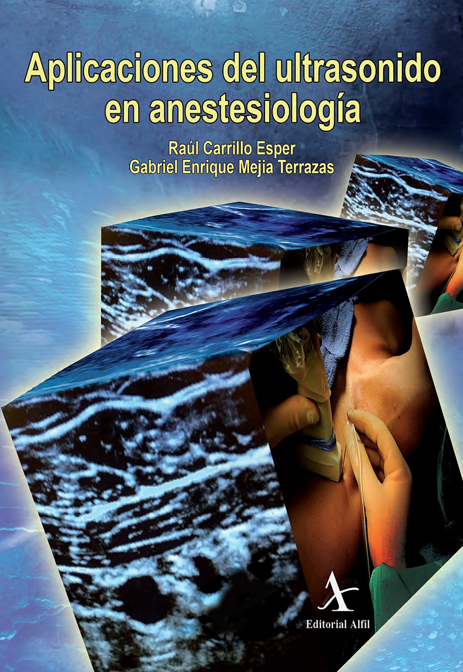 Cover Aplicaciones del ultrasonido en anestesiología
