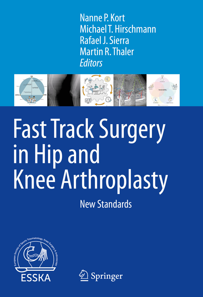 Cover Fast Track Surgery in Hip and Knee Arthroplasty