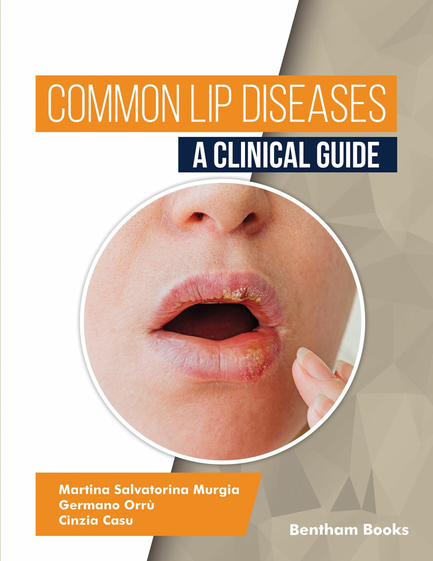 Cover Common Lip Diseases: A Clinical Guide