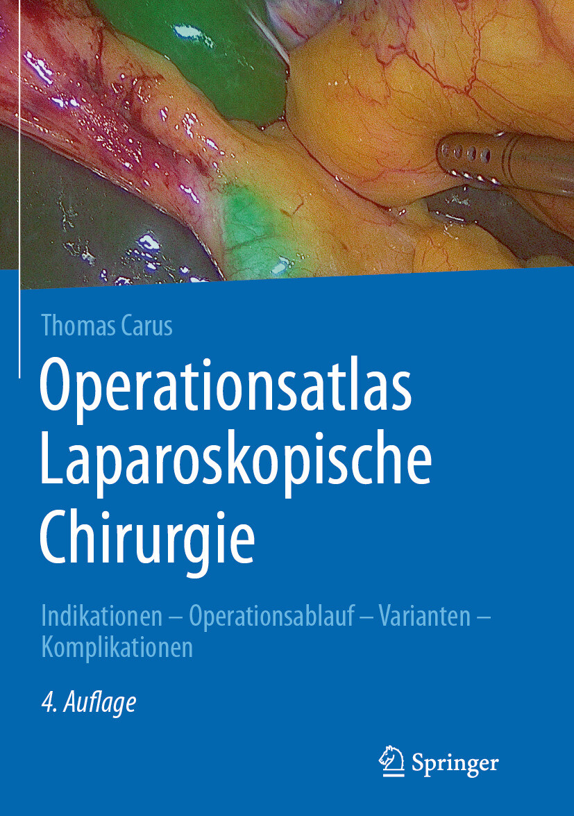 Cover Operationsatlas Laparoskopische Chirurgie