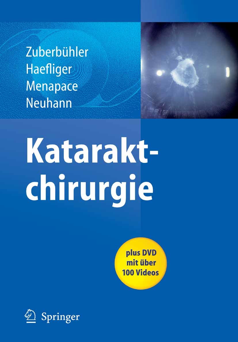 Cover Kataraktchirurgie