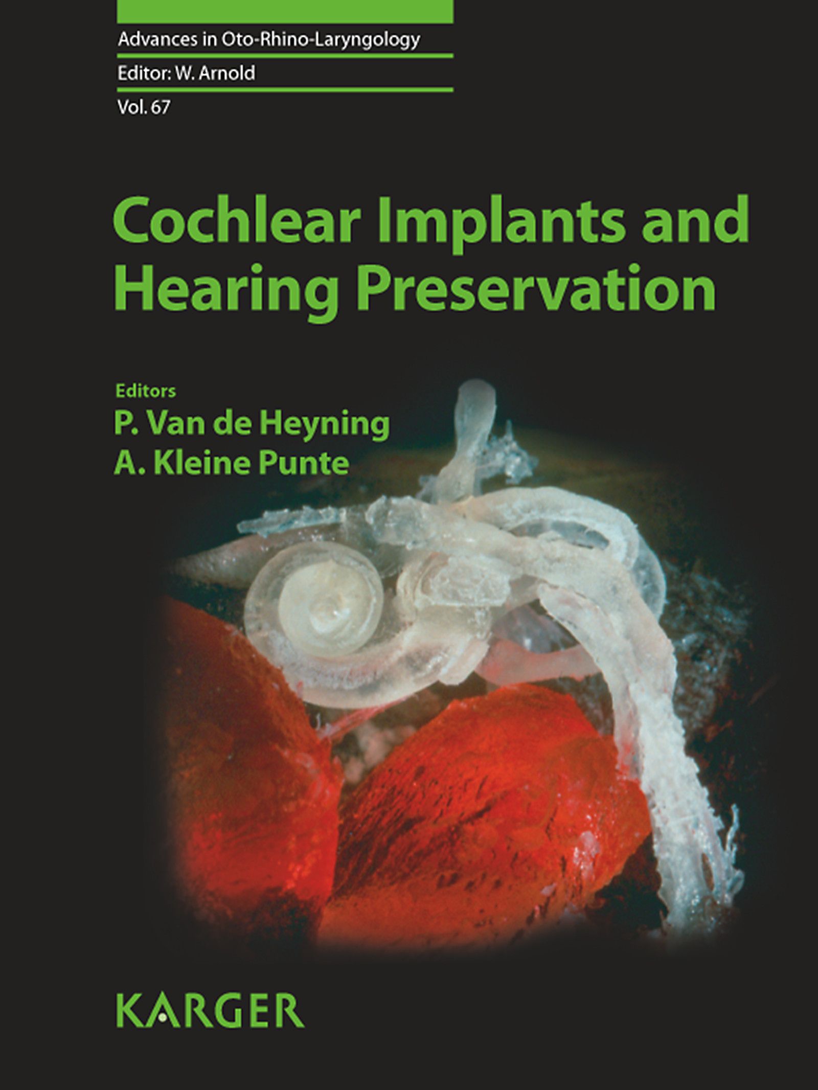 Cover Cochlear Implants and Hearing Preservation