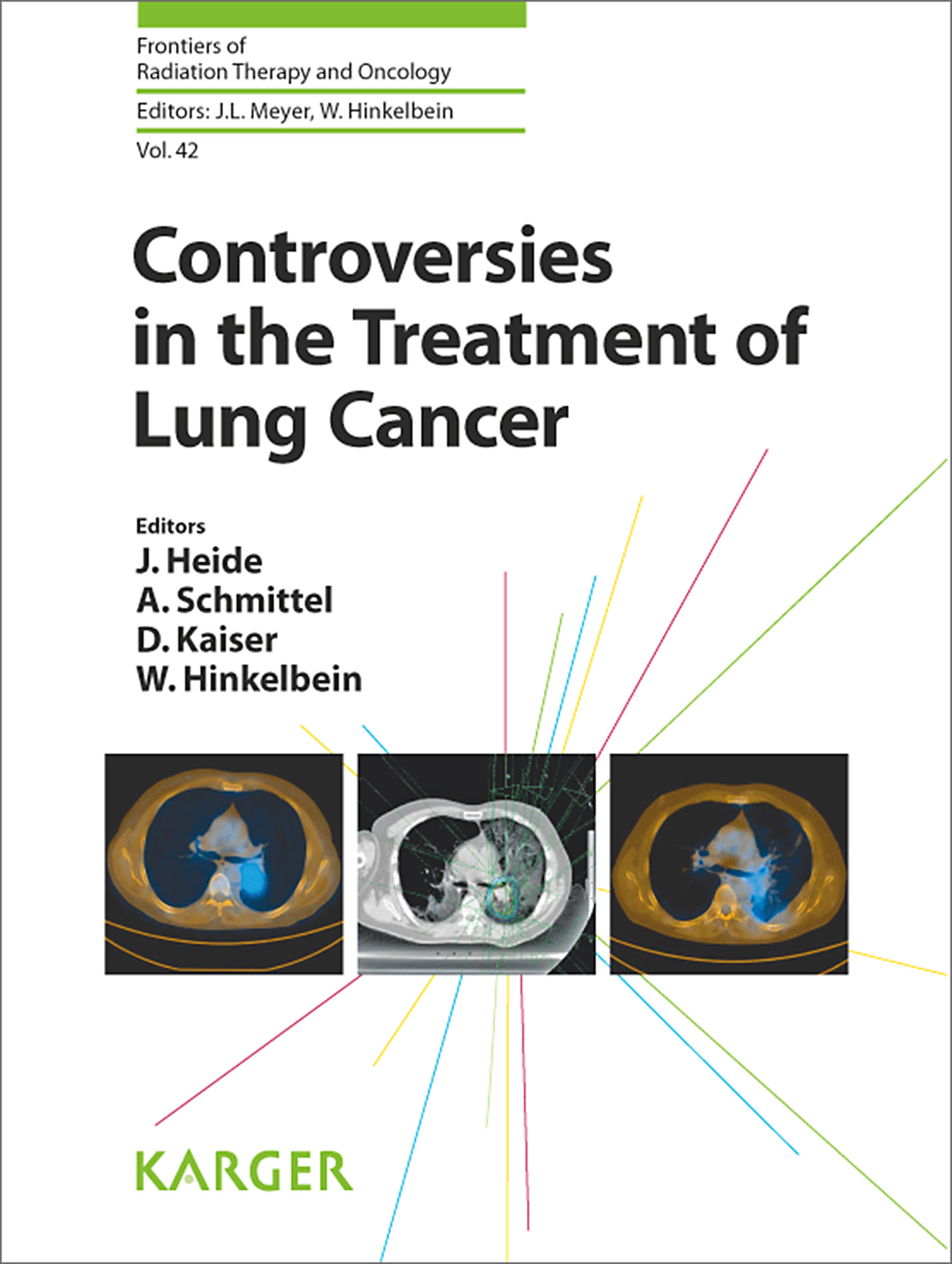 Cover Controversies in the Treatment of Lung Cancer