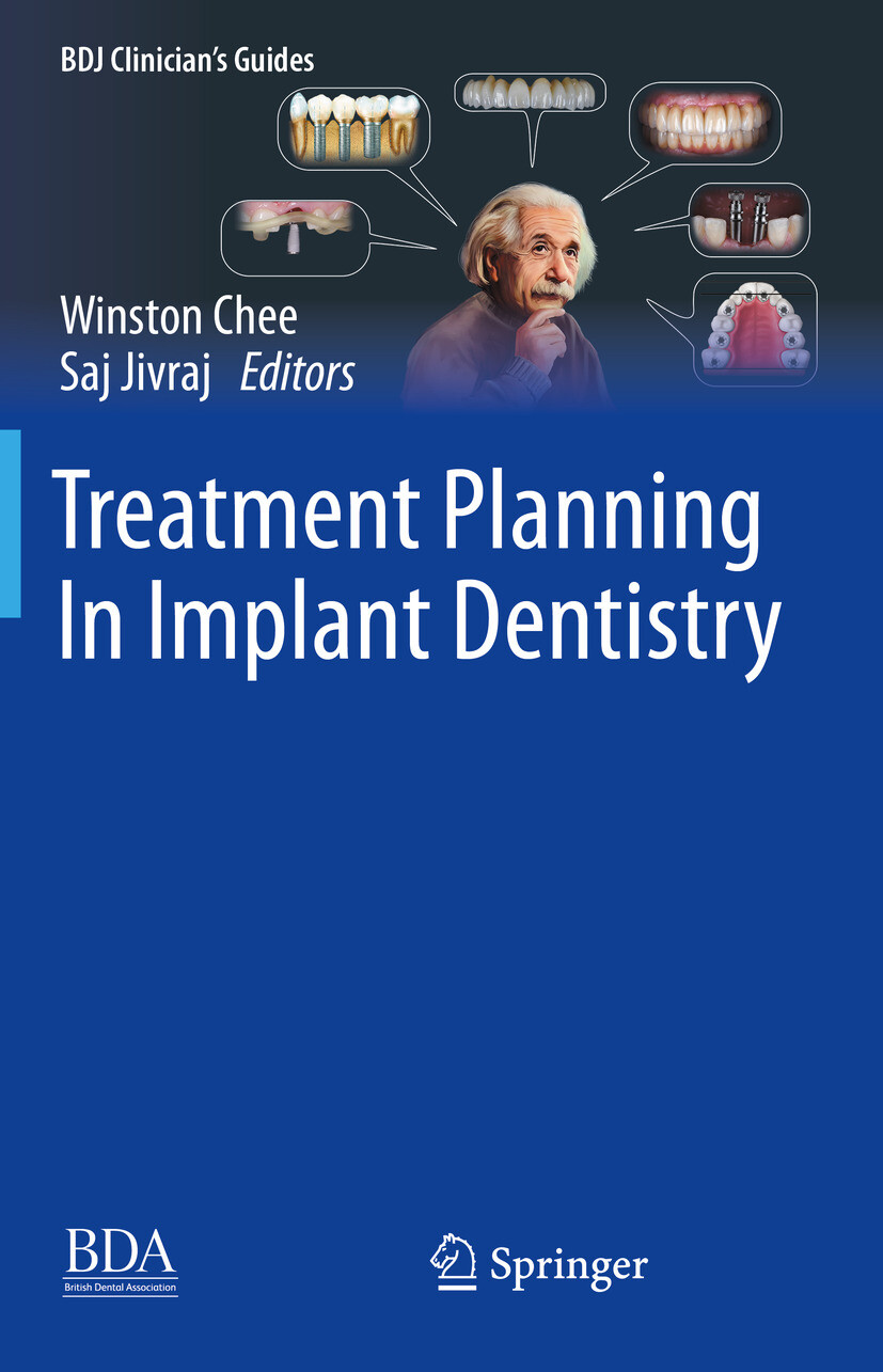 Cover Treatment Planning In Implant Dentistry