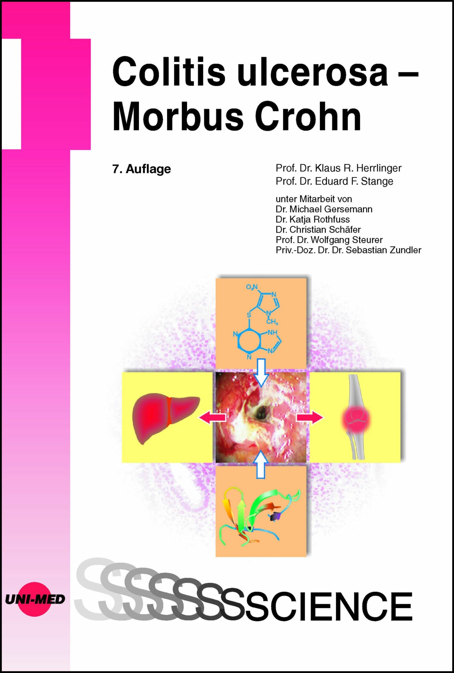 Cover Colitis ulcerosa - Morbus Crohn