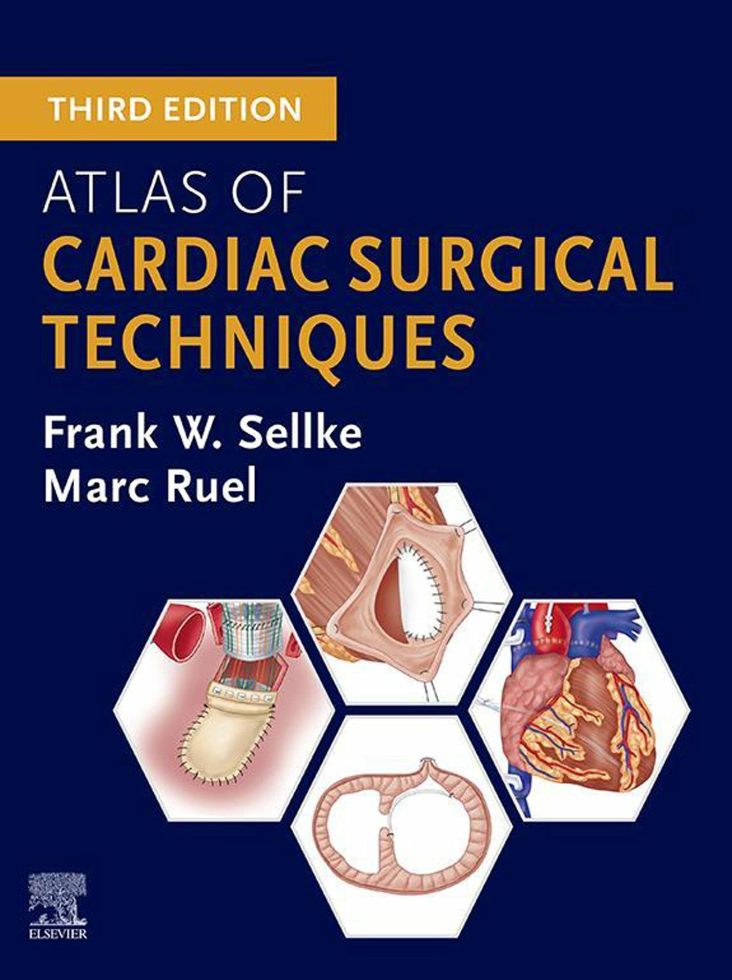 Cover Atlas of Cardiac Surgical Techniques - E-BOOK