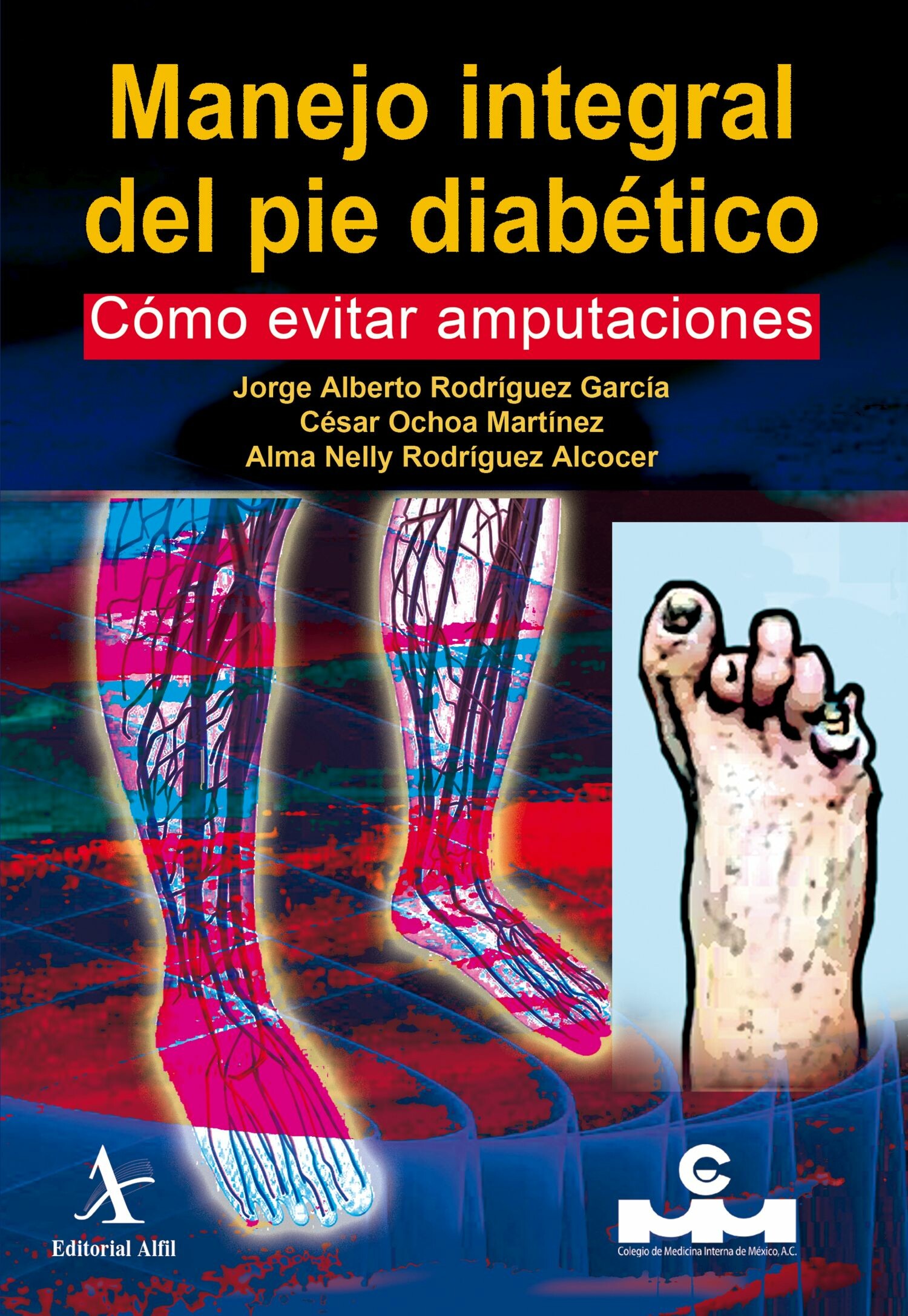 Manejo integral del pie diabético. Cómo evitar amputaciones