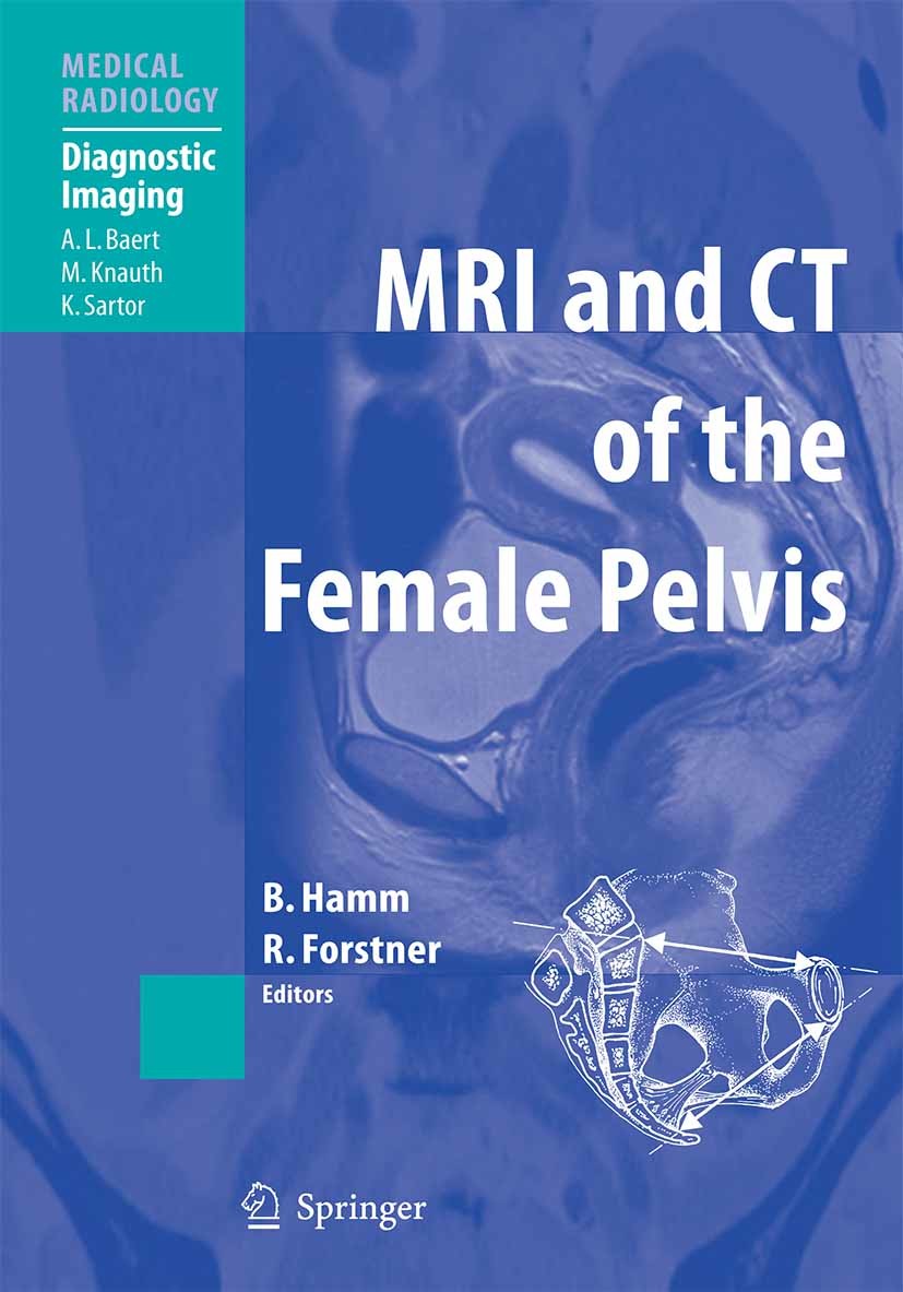 Cover MRI and CT of the Female Pelvis