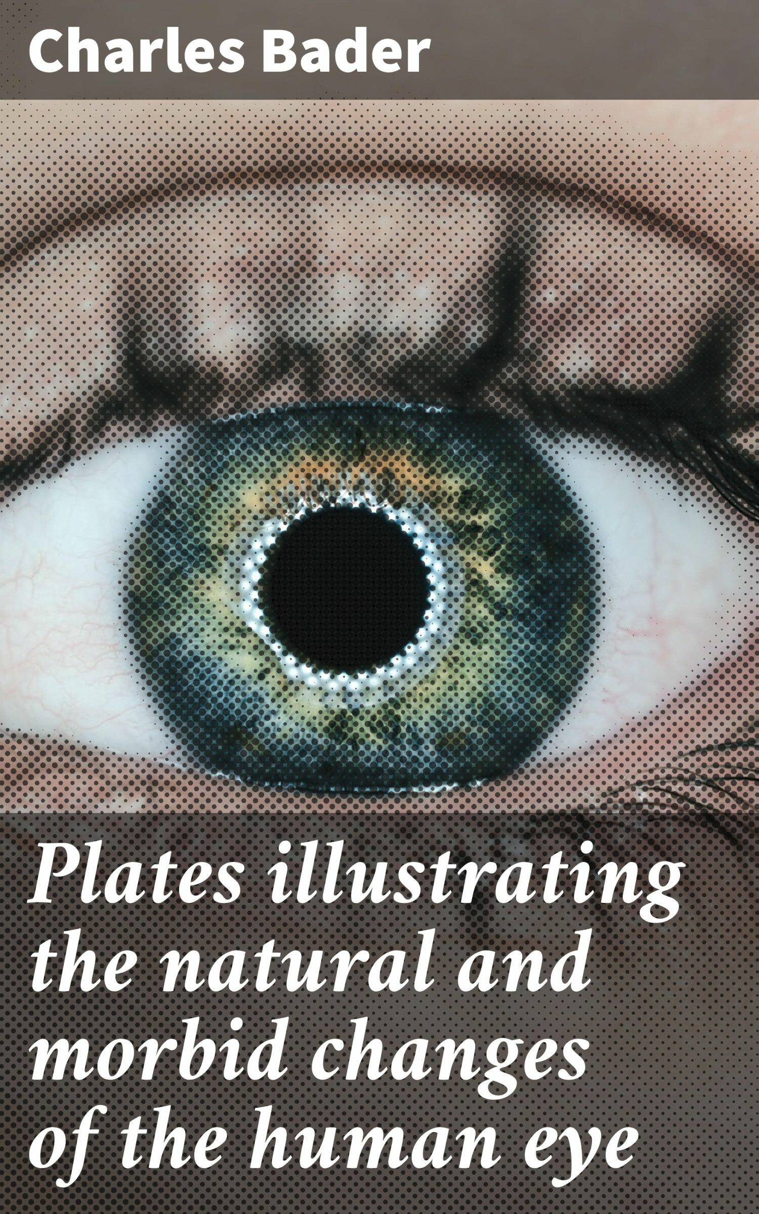 Cover Plates illustrating the natural and morbid changes of the human eye