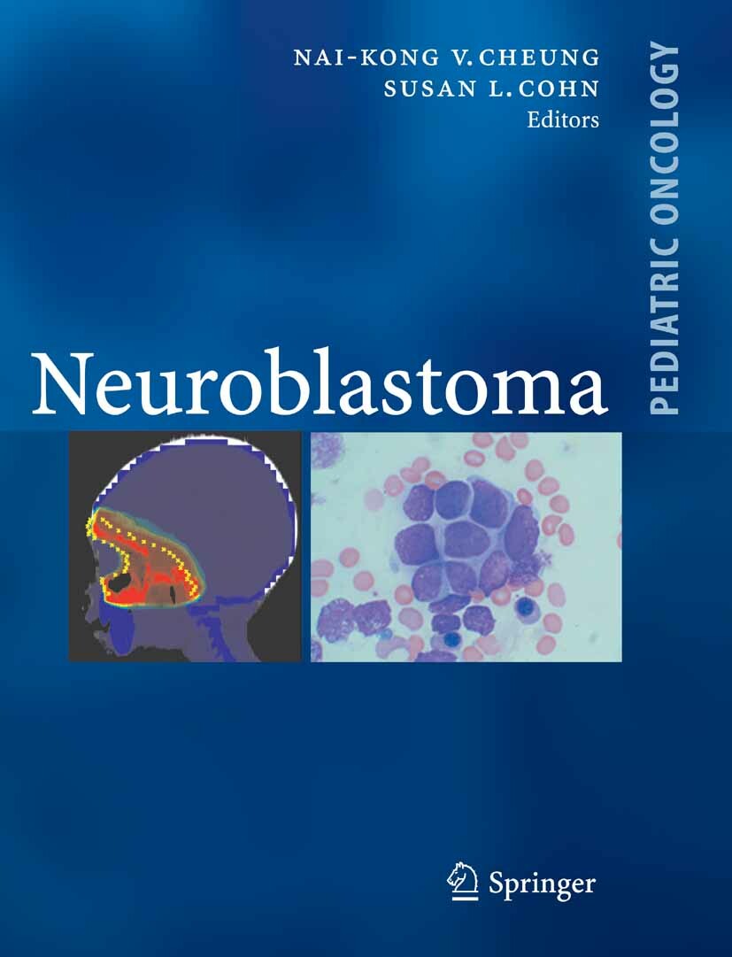 Neuroblastoma