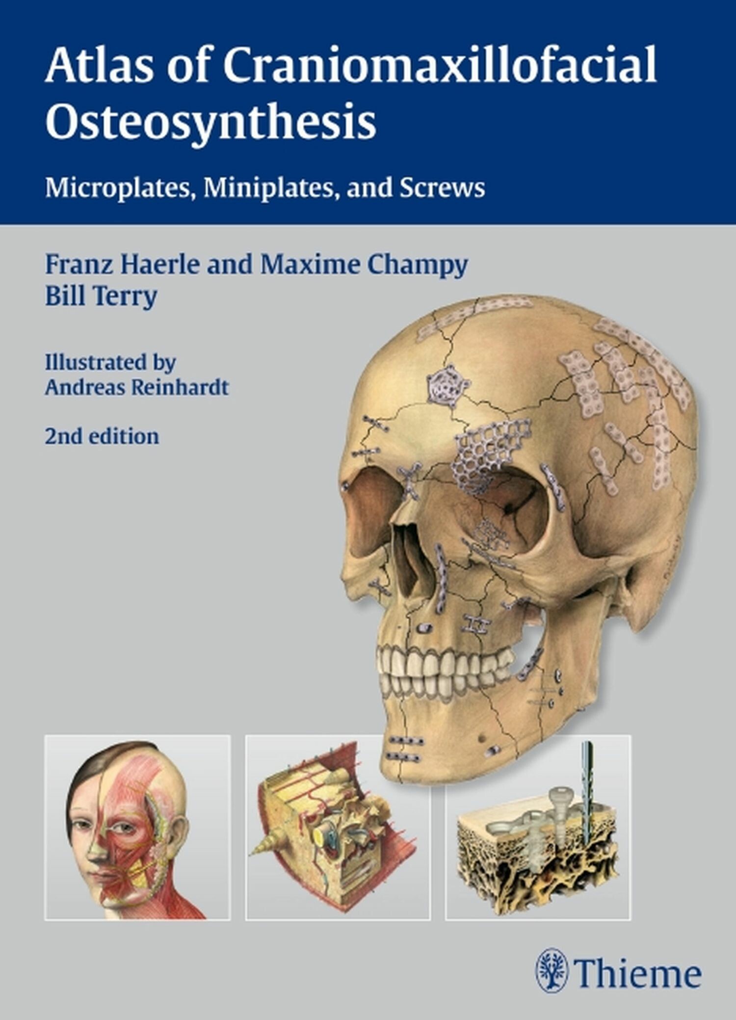 Cover Atlas of Craniomaxillofacial Osteosynthesis