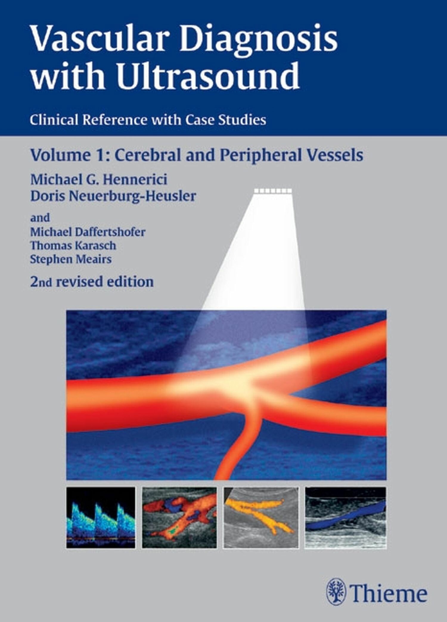 Cover Vascular Diagnosis with Ultrasound