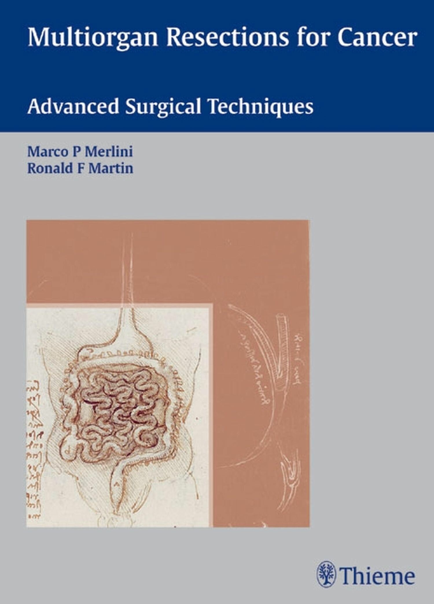 Multiorgan Resections for Cancer